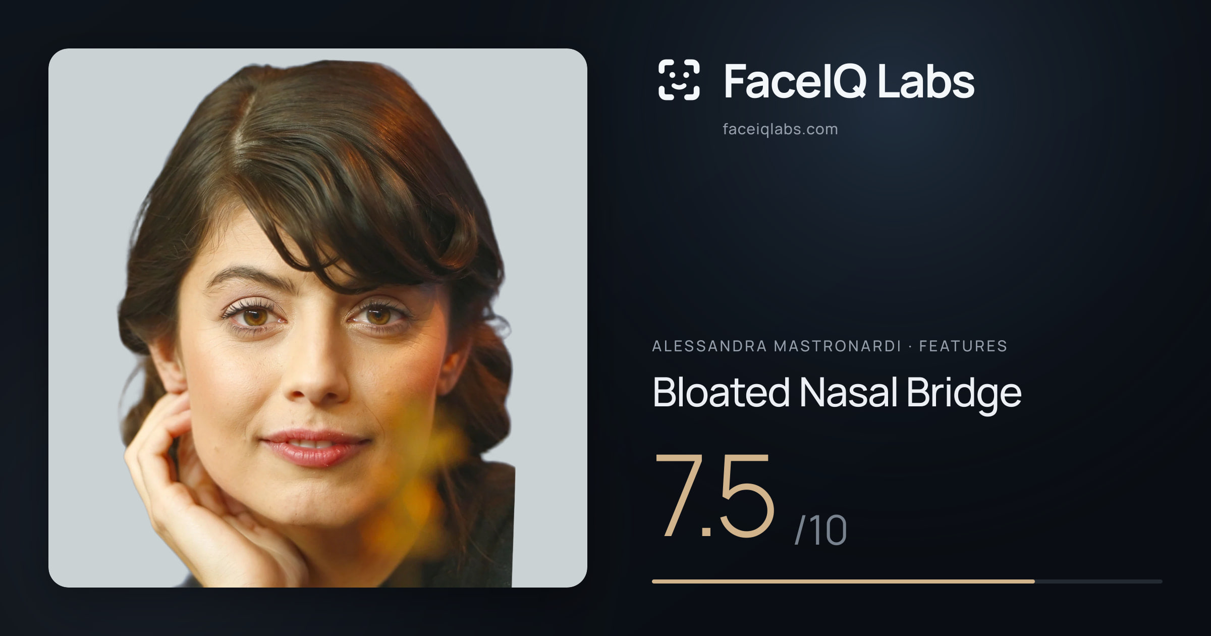 Alessandra Mastronardi Bloated Nasal Bridge: 7.5/10, drawn on the photo