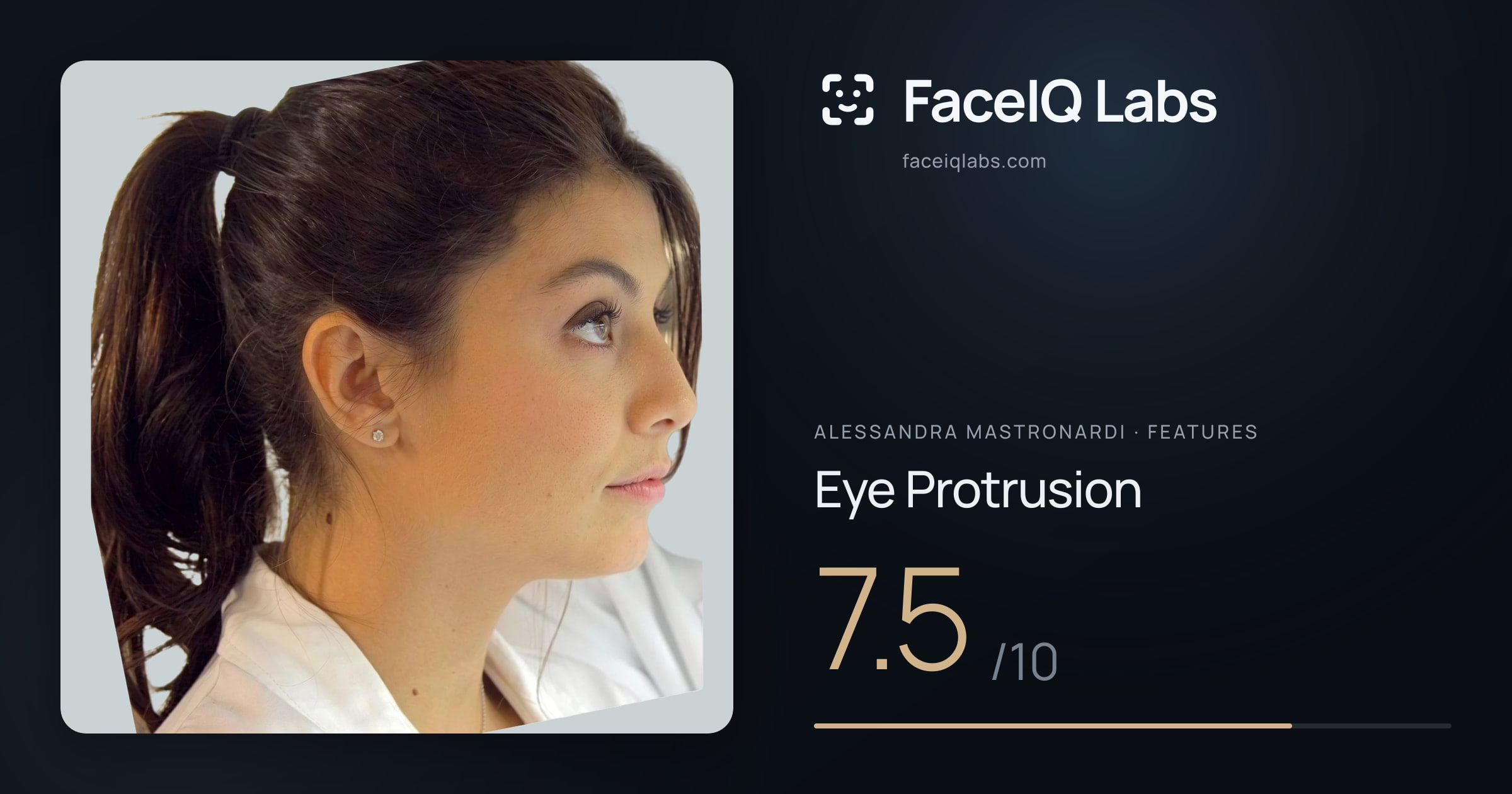 Alessandra Mastronardi Eye Protrusion: 7.5/10, drawn on the photo