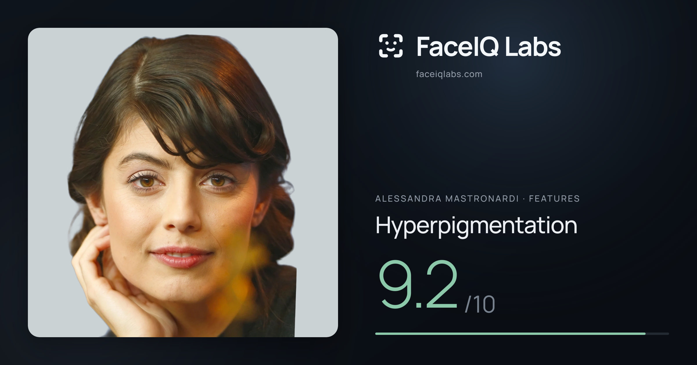 Alessandra Mastronardi Hyperpigmentation: 9.2/10, drawn on the photo