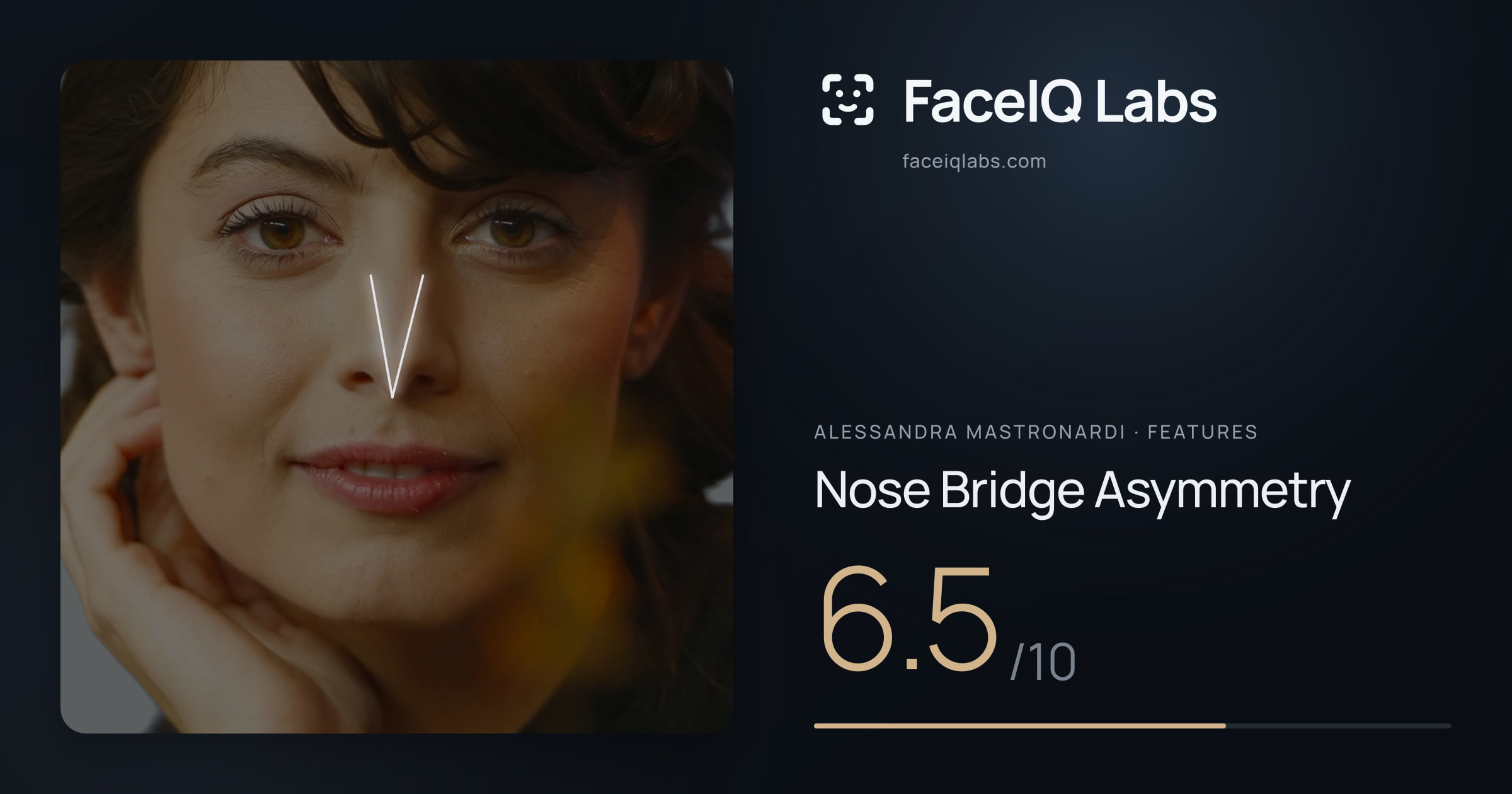 Alessandra Mastronardi Nose Bridge Asymmetry: 6.5/10, drawn on the photo