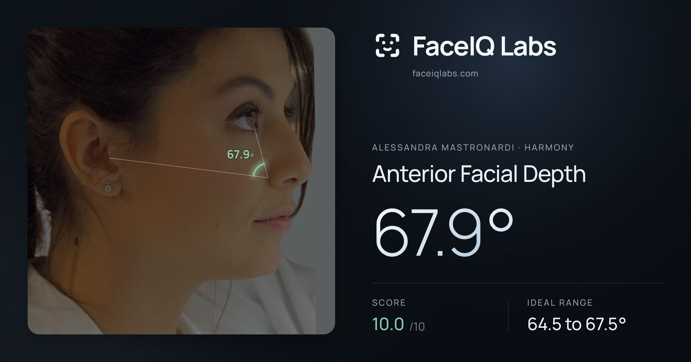 Alessandra Mastronardi Anterior Facial Depth: 67.9°, drawn on the photo