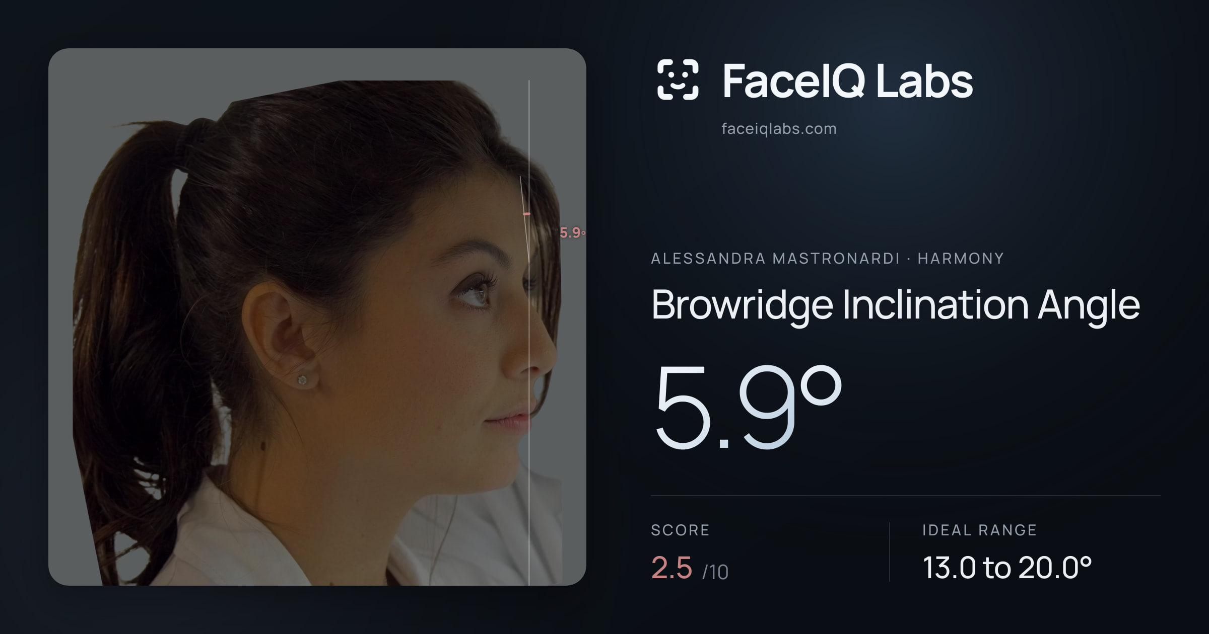 Alessandra Mastronardi Browridge Inclination Angle: 5.9°, drawn on the photo