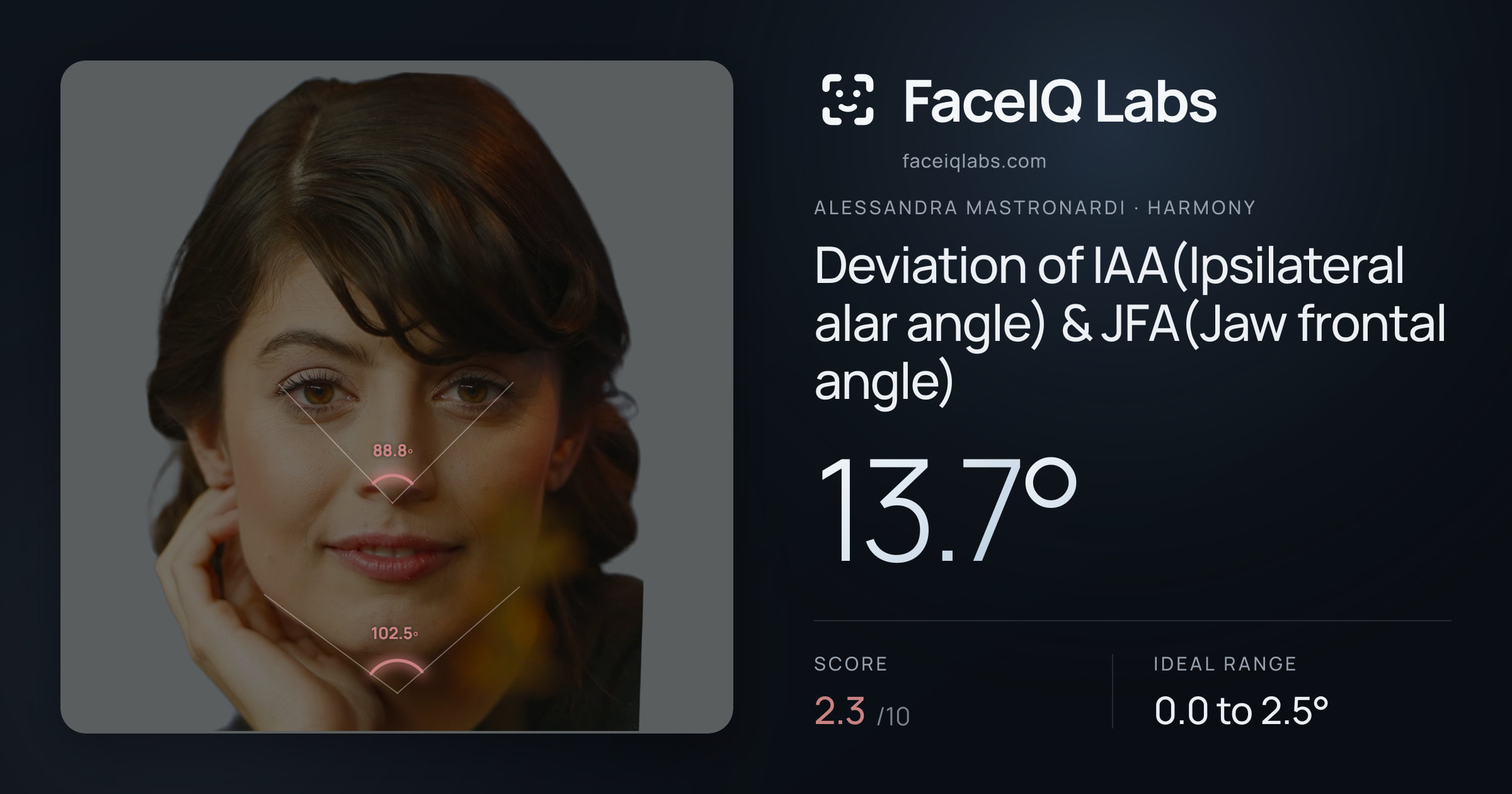 Alessandra Mastronardi Deviation of IAA(Ipsilateral alar angle) & JFA(Jaw frontal angle): 13.7°, drawn on the photo