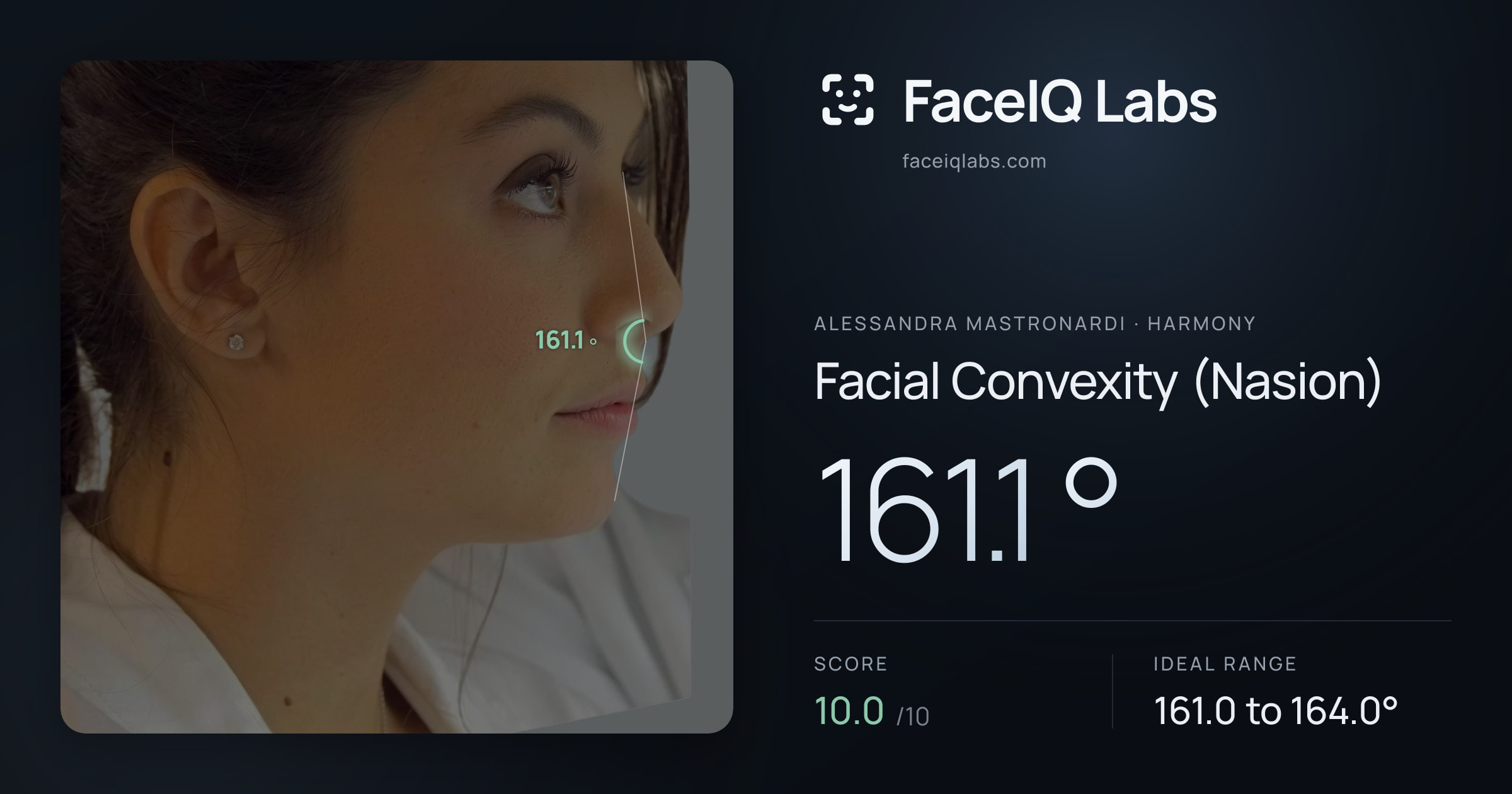 Alessandra Mastronardi Facial Convexity (Nasion): 161.1°, drawn on the photo