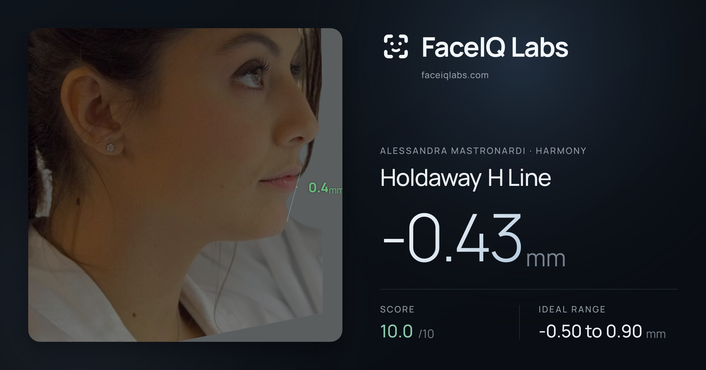 Alessandra Mastronardi Holdaway H Line: -0.43mm, drawn on the photo