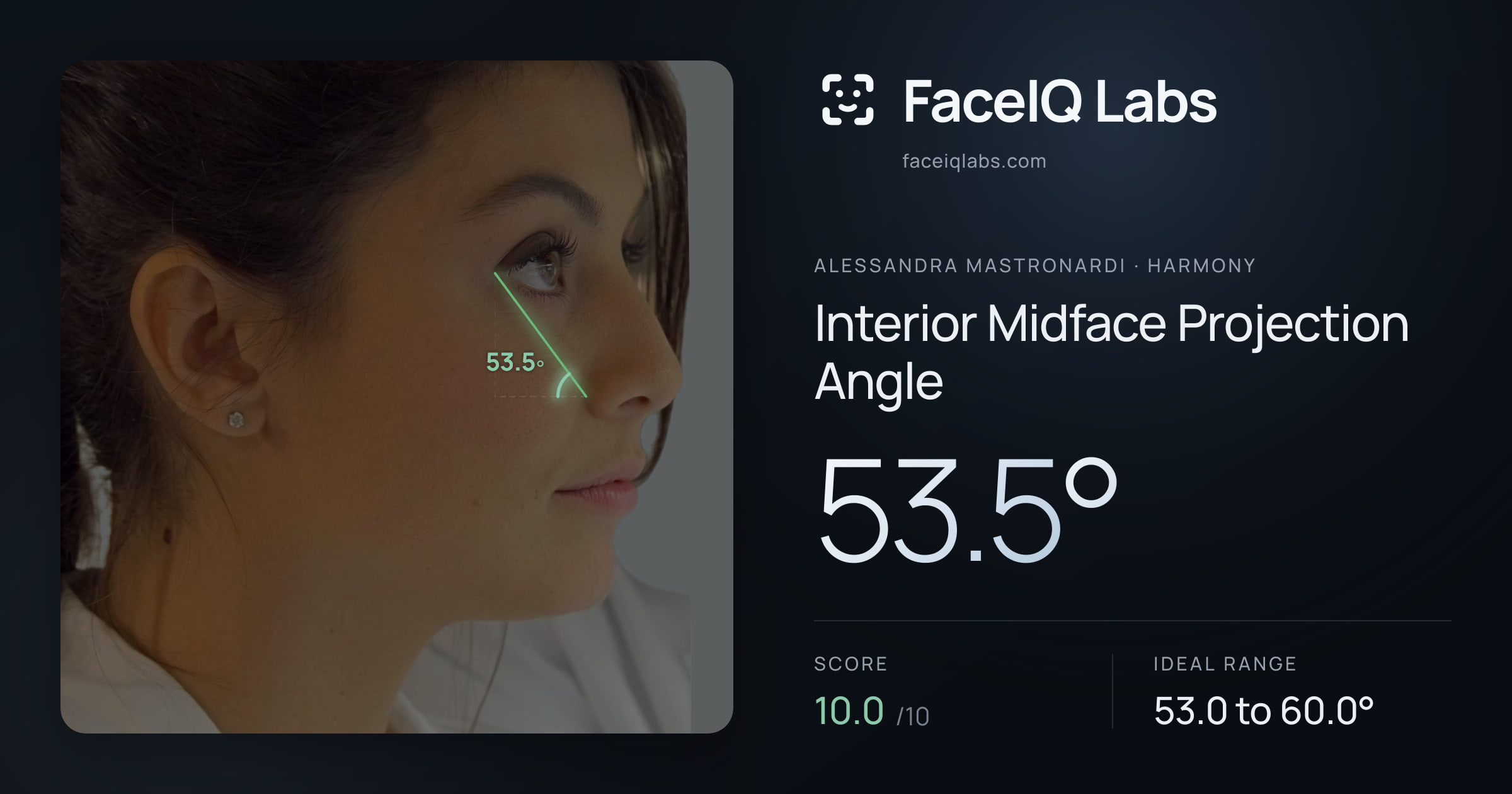 Alessandra Mastronardi Interior Midface Projection Angle: 53.5°, drawn on the photo