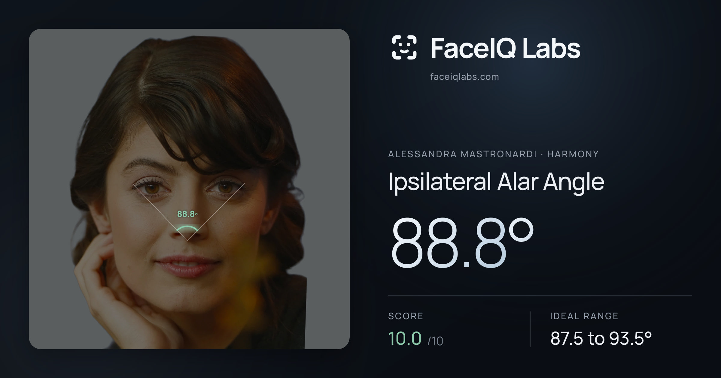 Alessandra Mastronardi Ipsilateral Alar Angle: 88.8°, drawn on the photo