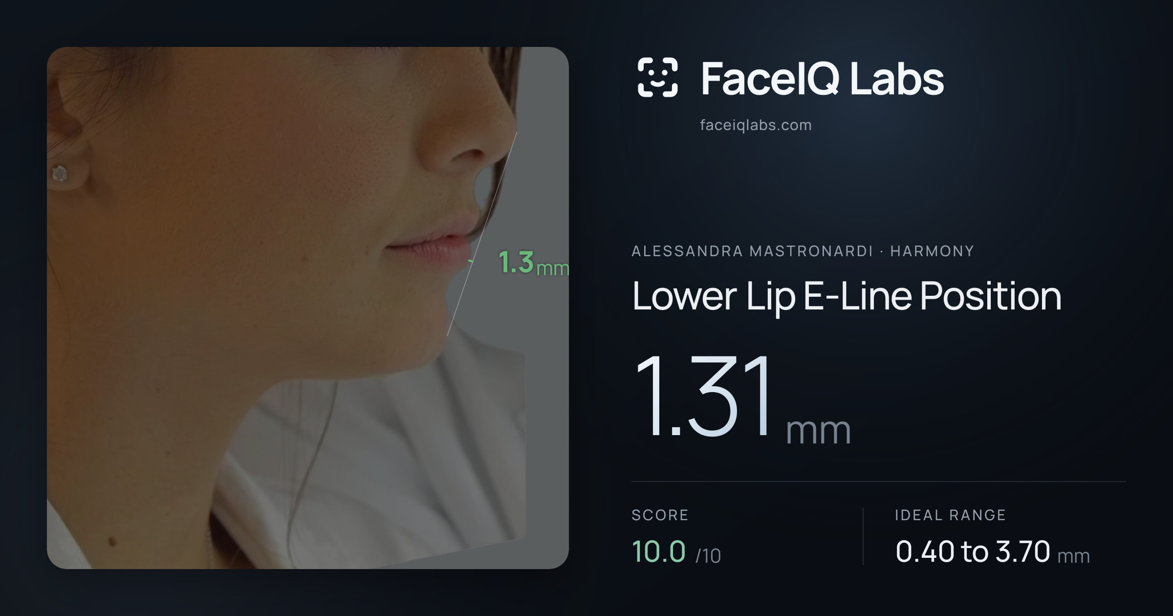 Alessandra Mastronardi Lower Lip E-Line Position: 1.31mm, drawn on the photo