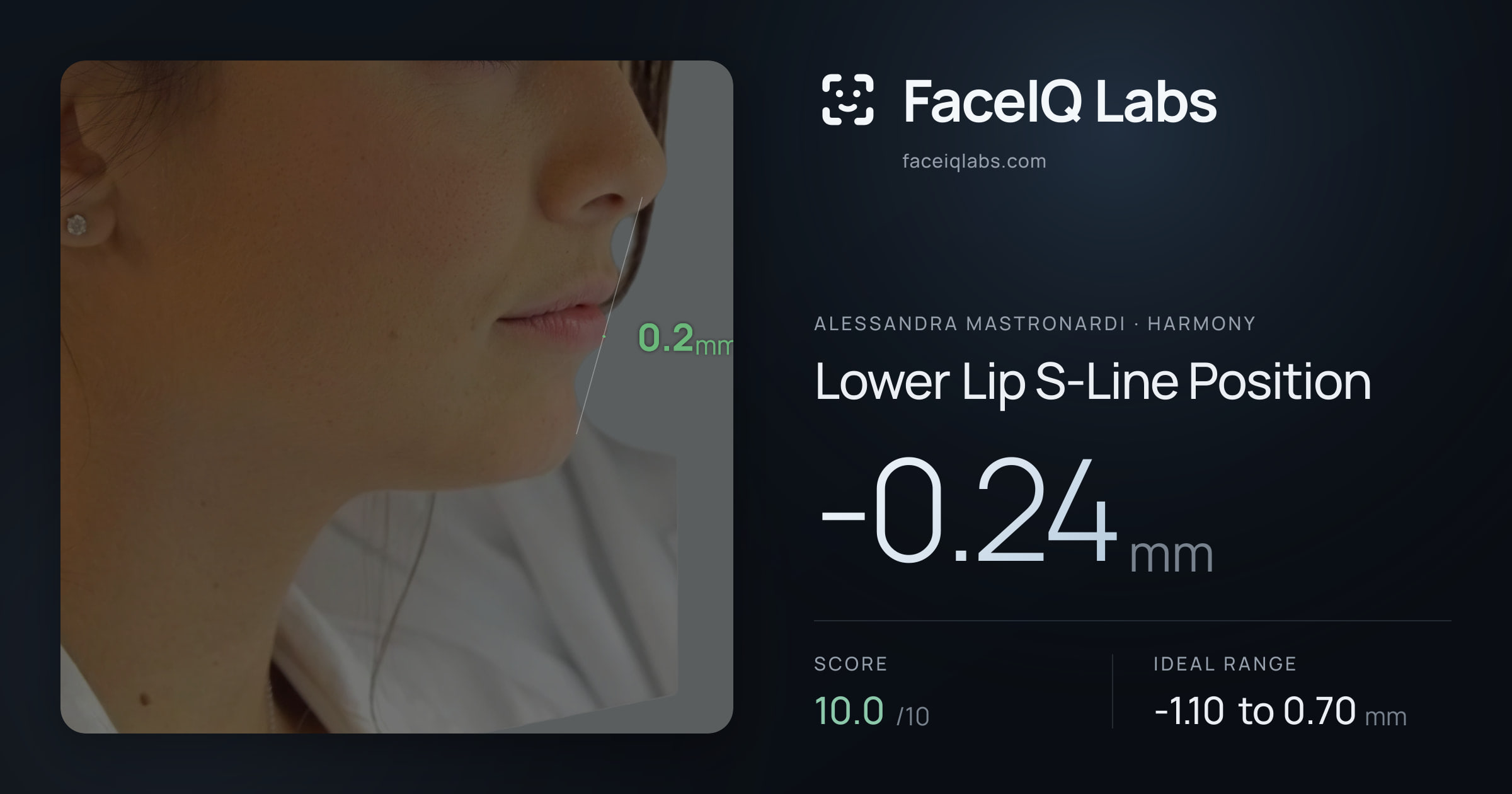Alessandra Mastronardi Lower Lip S-Line Position: -0.24mm, drawn on the photo