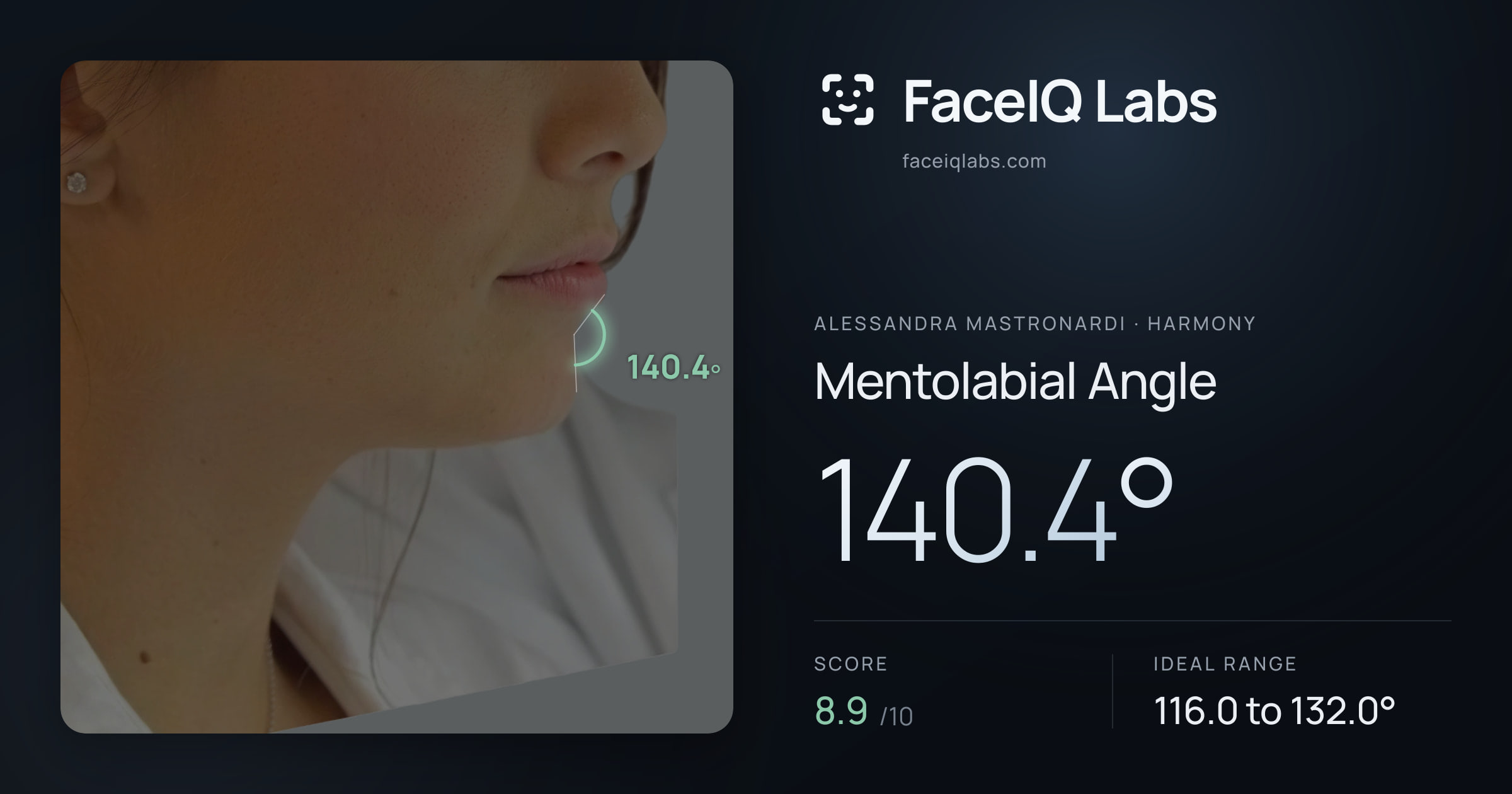 Alessandra Mastronardi Mentolabial Angle: 140.4°, drawn on the photo