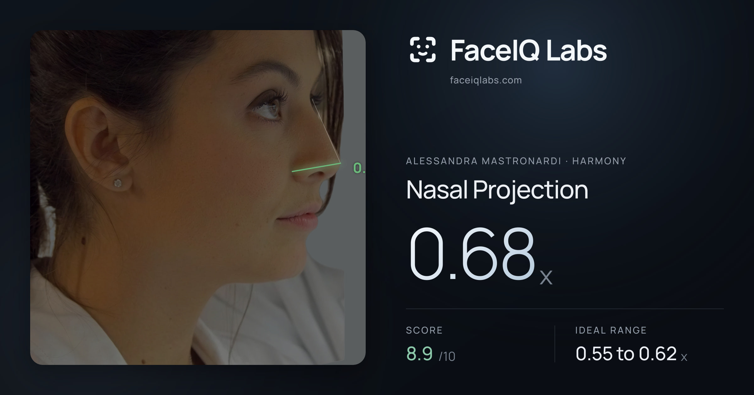 Alessandra Mastronardi Nasal Projection: 0.68x, drawn on the photo