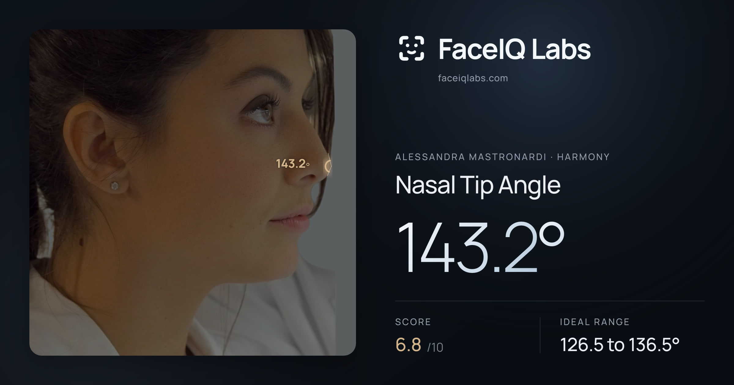 Alessandra Mastronardi Nasal Tip Angle: 143.2°, drawn on the photo