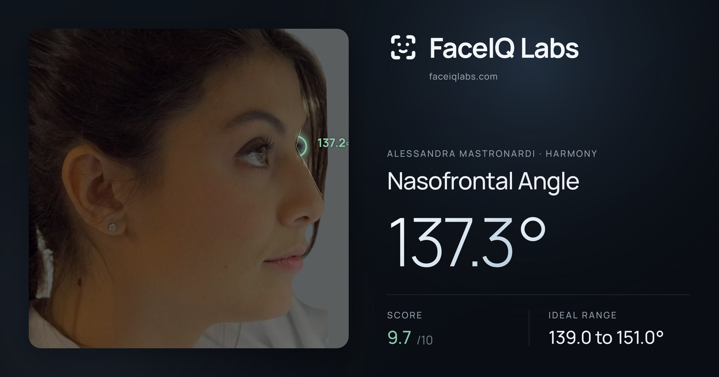 Alessandra Mastronardi Nasofrontal Angle: 137.3°, drawn on the photo