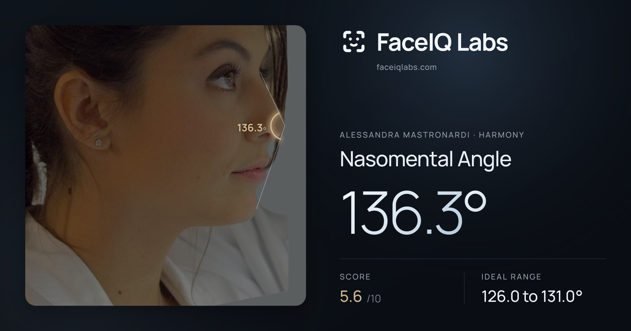 Alessandra Mastronardi Nasomental Angle: 136.3°, drawn on the photo