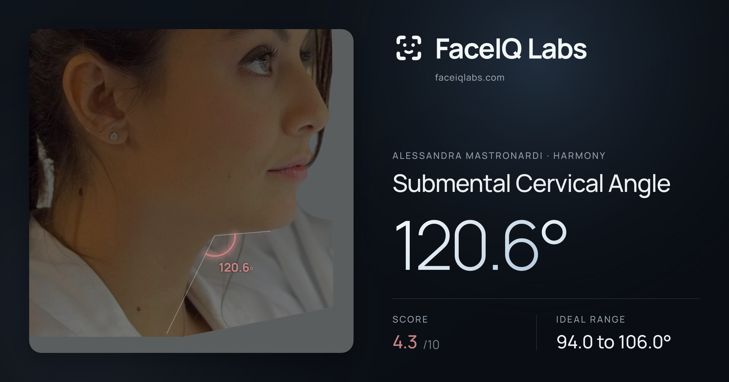 Alessandra Mastronardi Submental Cervical Angle: 120.6°, drawn on the photo