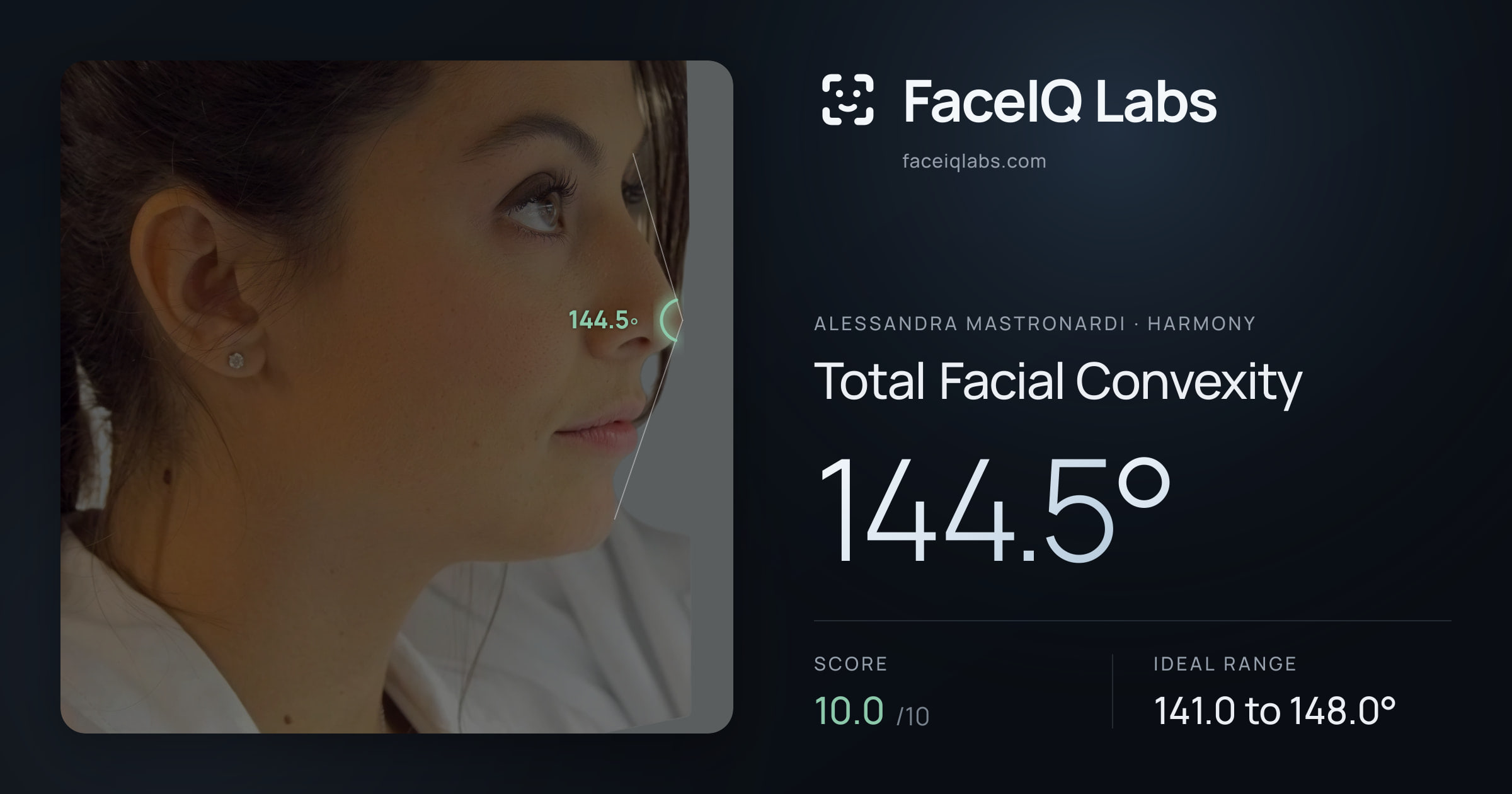 Alessandra Mastronardi Total Facial Convexity: 144.5°, drawn on the photo