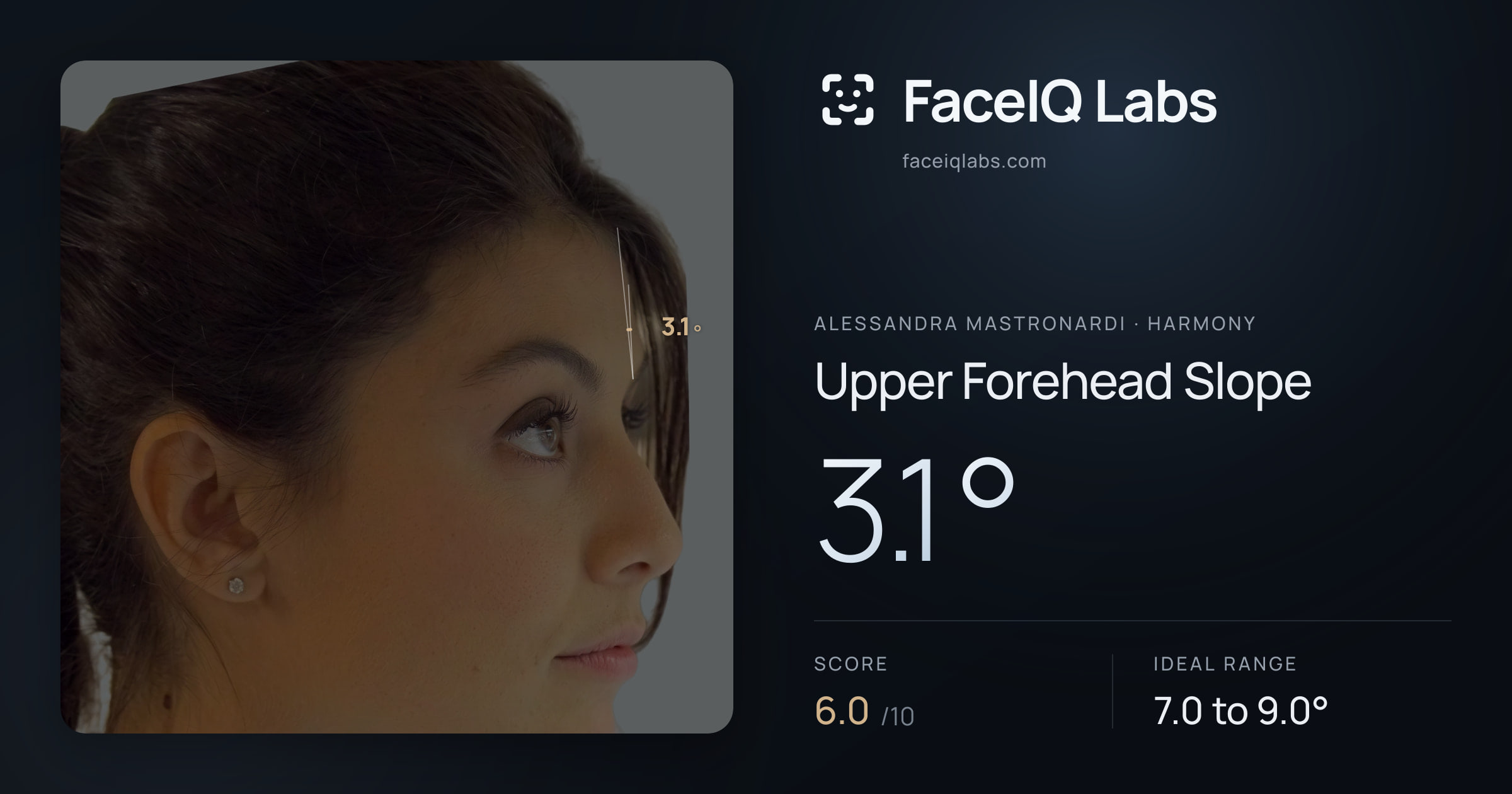 Alessandra Mastronardi Upper Forehead Slope: 3.1°, drawn on the photo