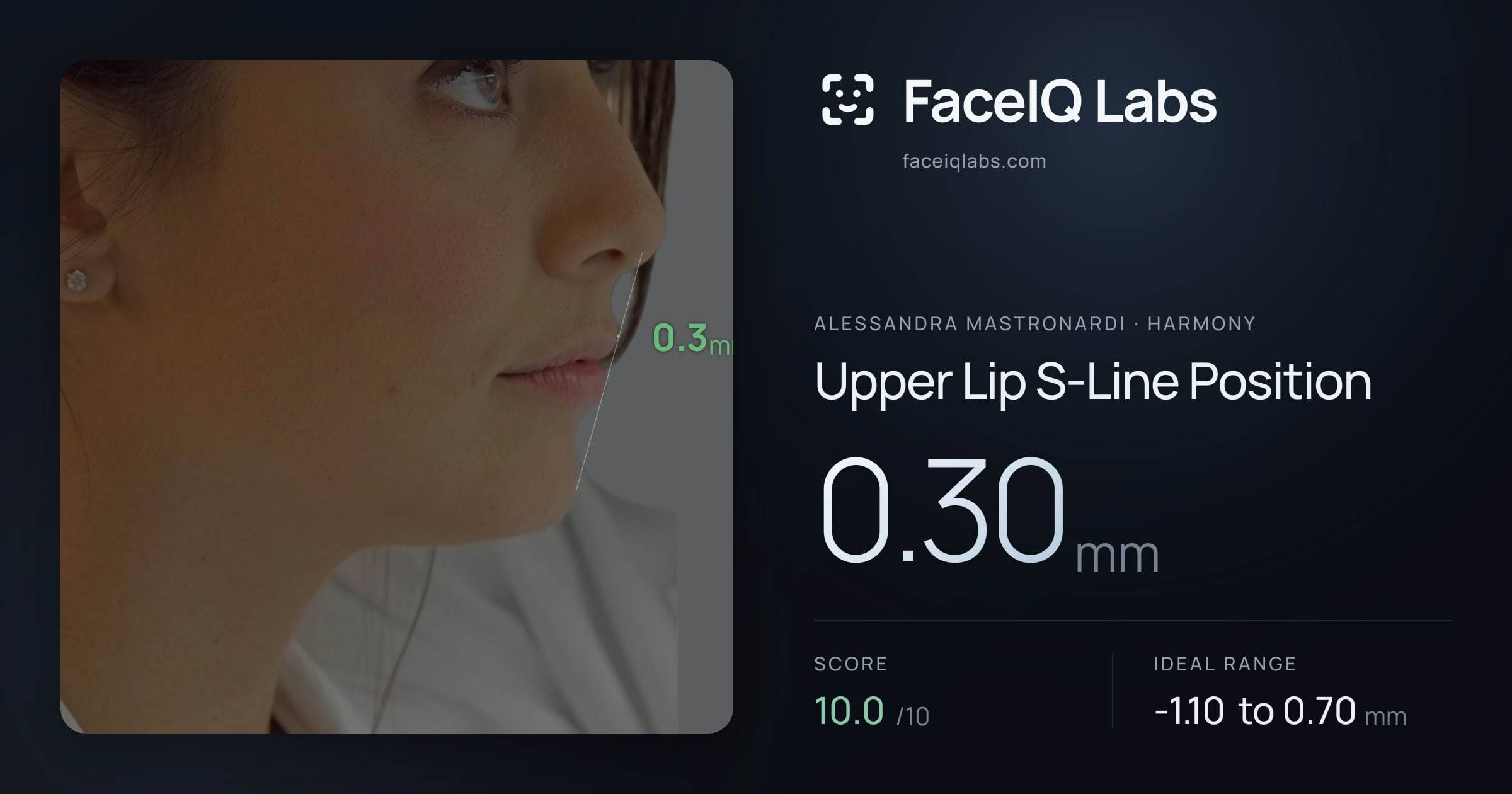 Alessandra Mastronardi Upper Lip S-Line Position: 0.30mm, drawn on the photo
