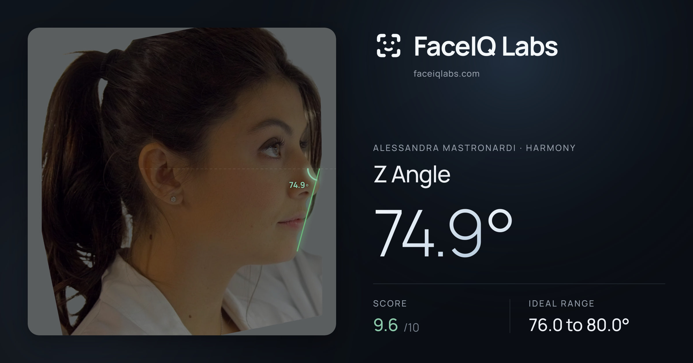 Alessandra Mastronardi Z Angle: 74.9°, drawn on the photo
