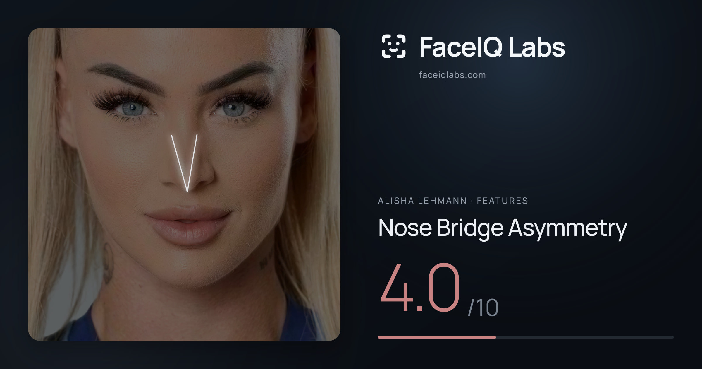 Alisha Lehmann Nose Bridge Asymmetry: 4.0/10, drawn on the photo