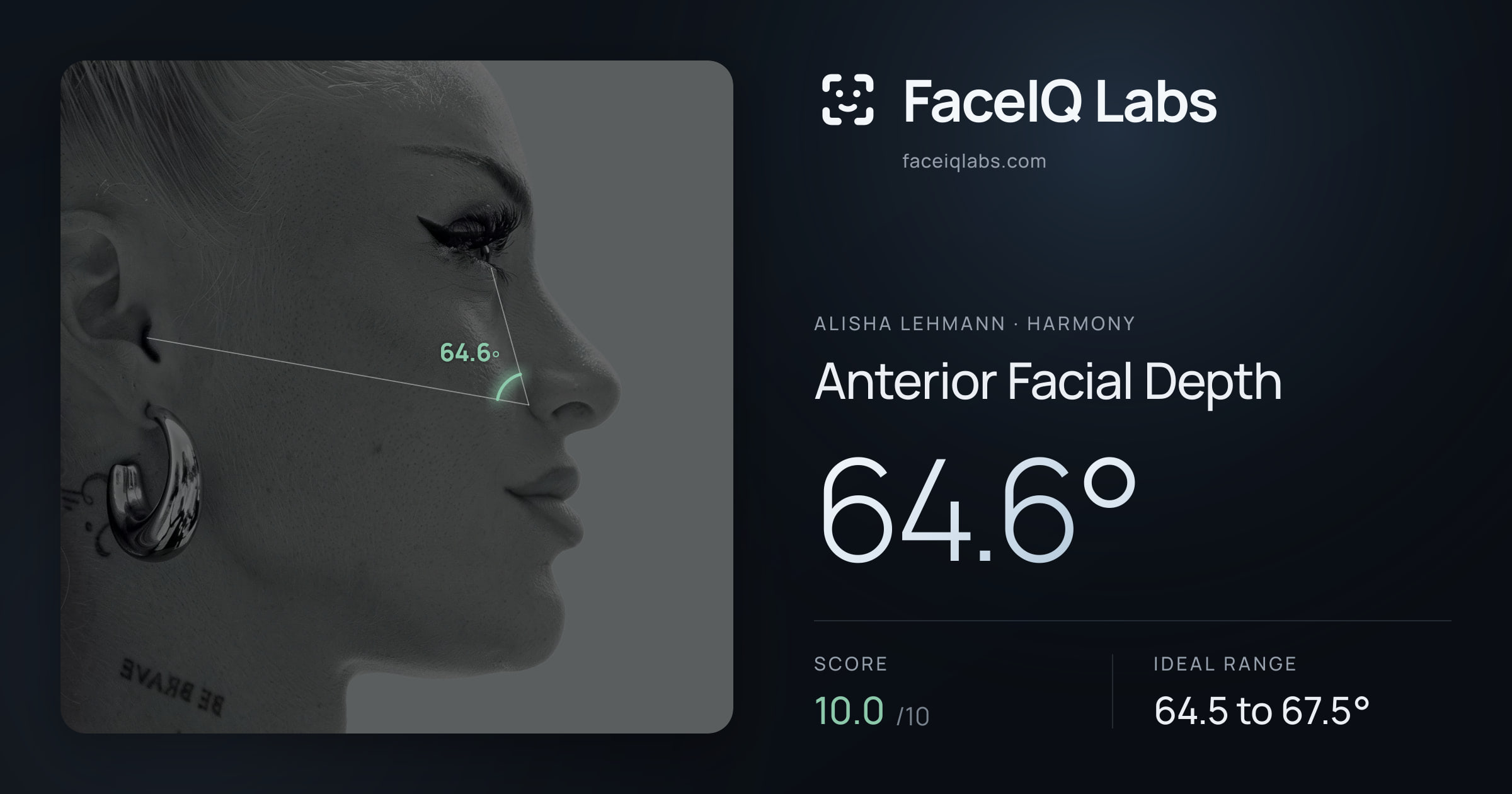 Alisha Lehmann Anterior Facial Depth: 64.6°, drawn on the photo