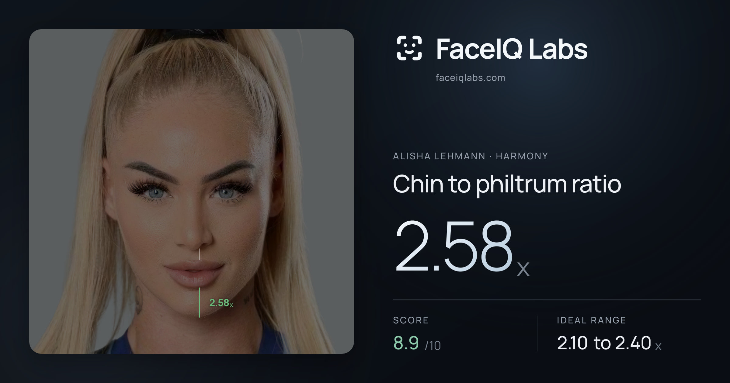 Alisha Lehmann Chin to philtrum ratio: 2.58x, drawn on the photo