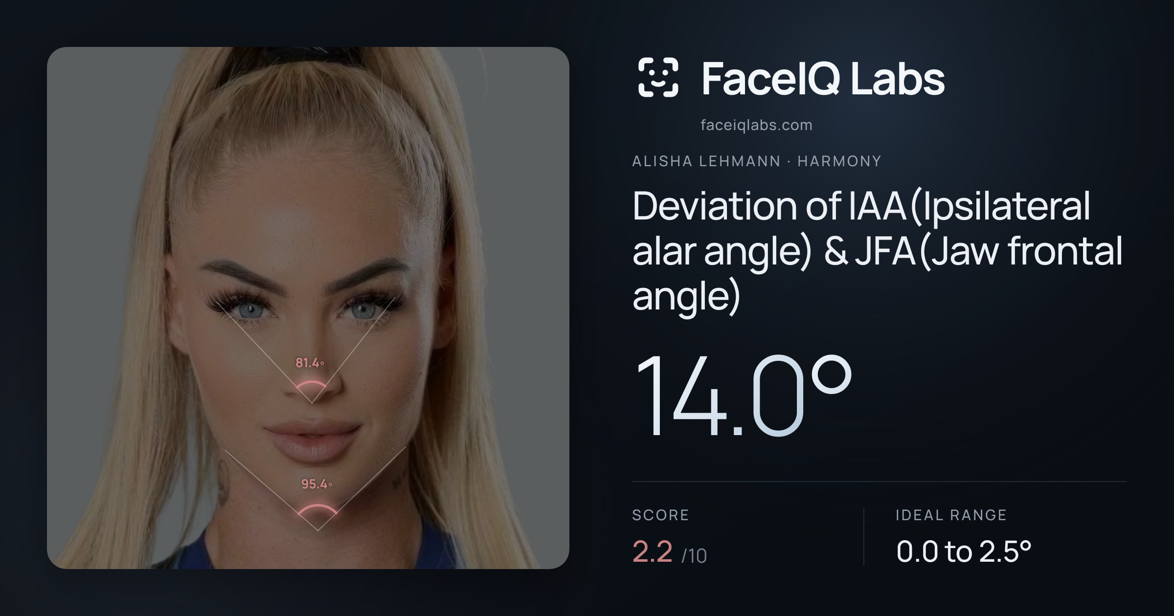 Alisha Lehmann Deviation of IAA(Ipsilateral alar angle) & JFA(Jaw frontal angle): 14.0°, drawn on the photo