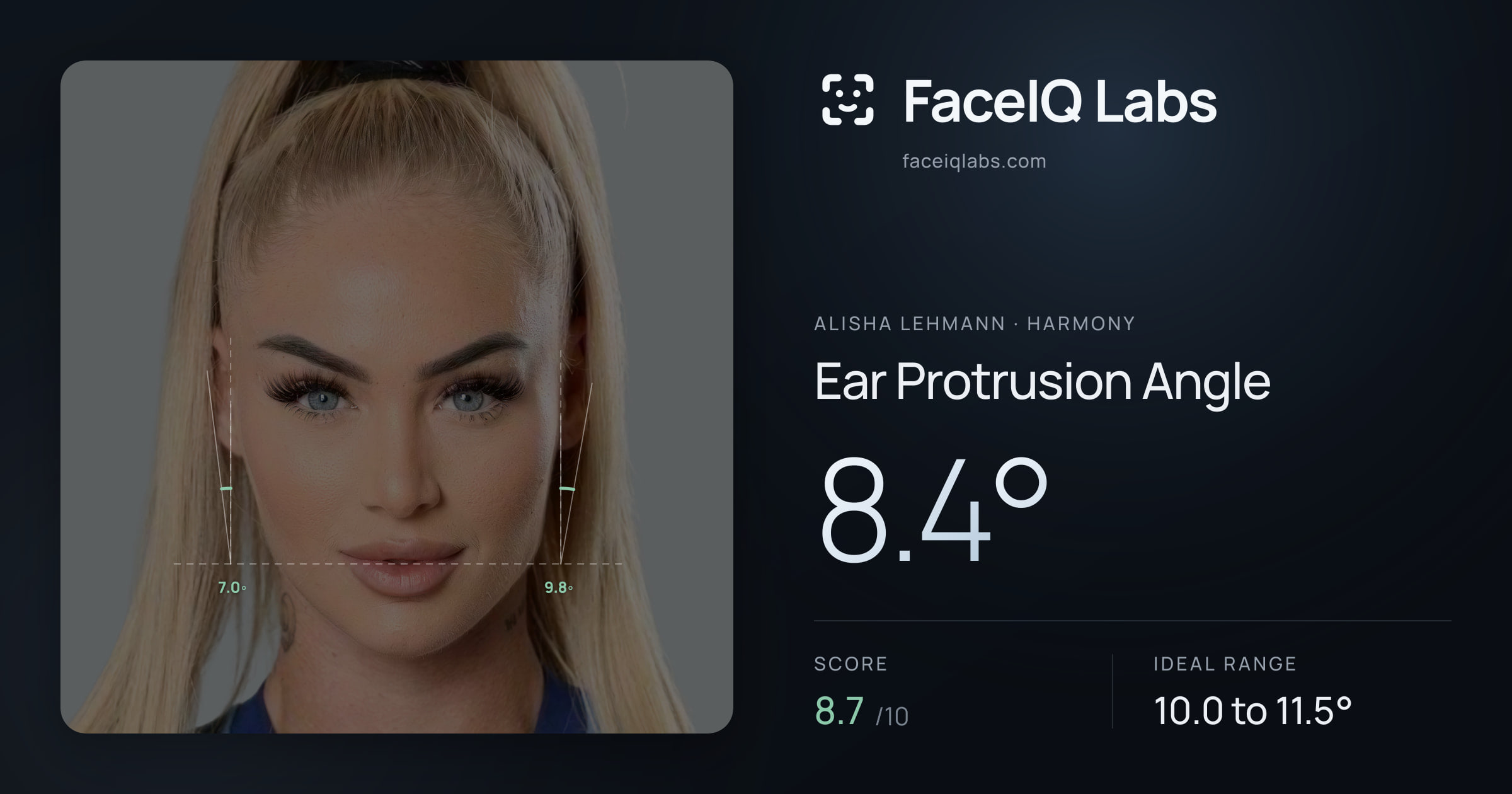 Alisha Lehmann Ear Protrusion Angle: 8.4°, drawn on the photo