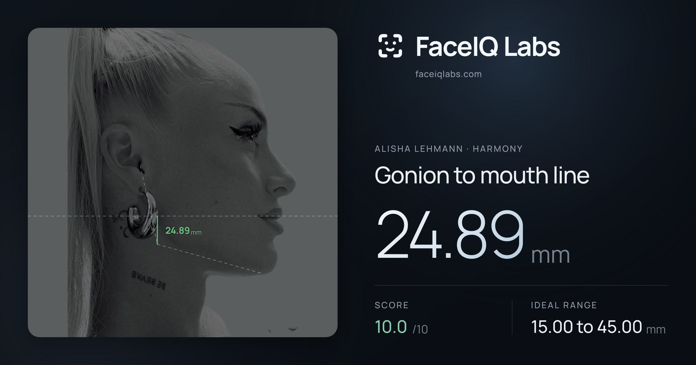 Alisha Lehmann Gonion to mouth line: 24.89mm, drawn on the photo