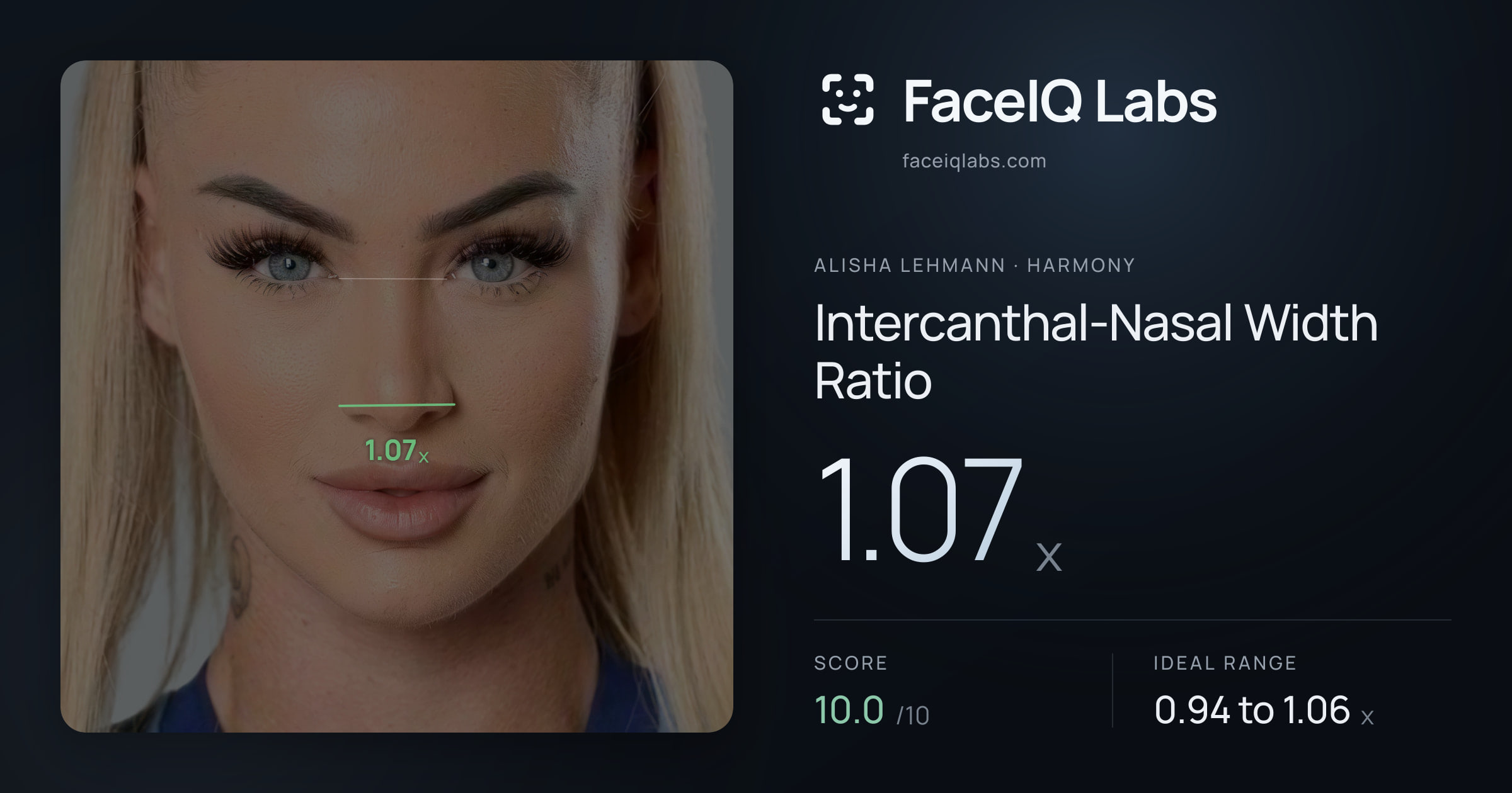 Alisha Lehmann Intercanthal-Nasal Width Ratio: 1.07x, drawn on the photo
