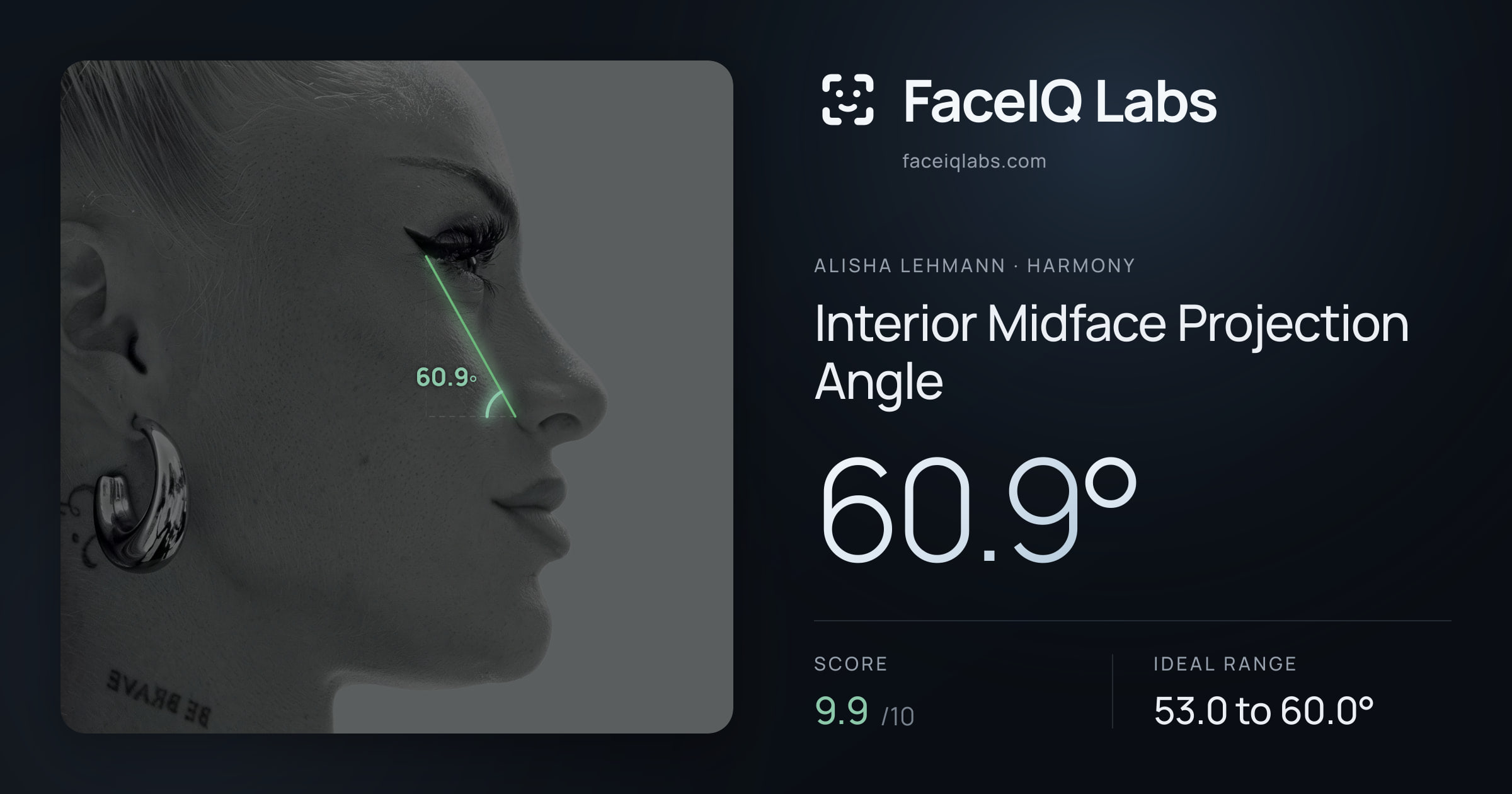 Alisha Lehmann Interior Midface Projection Angle: 60.9°, drawn on the photo