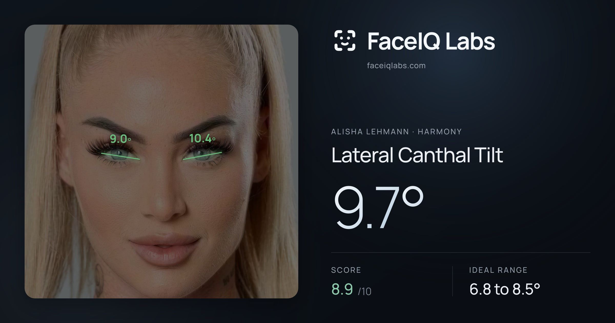 Alisha Lehmann Lateral Canthal Tilt: 9.7°, drawn on the photo