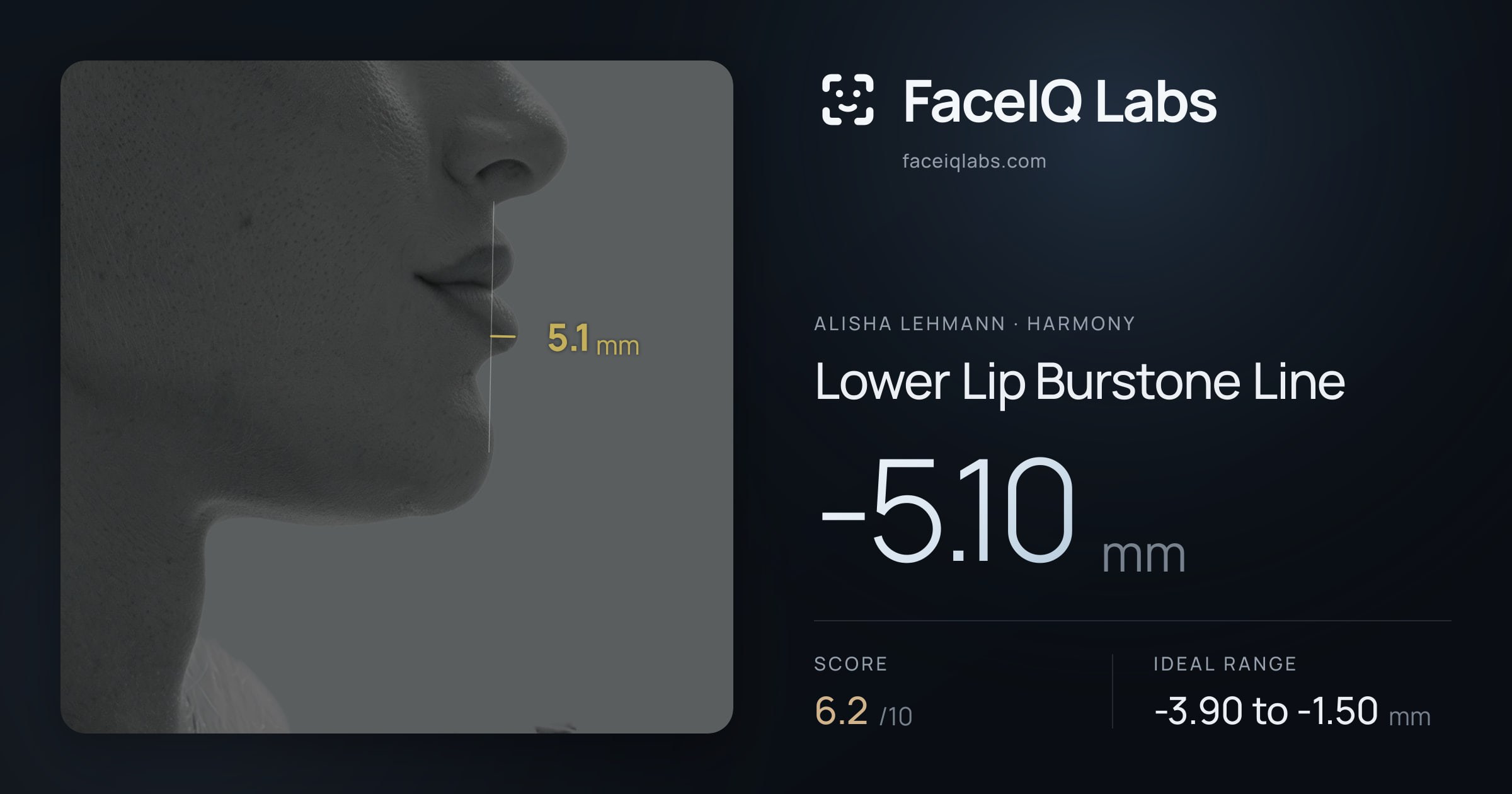 Alisha Lehmann Lower Lip Burstone Line: -5.10mm, drawn on the photo