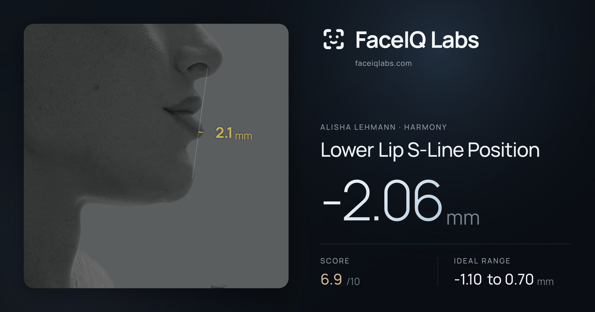 Alisha Lehmann Lower Lip S-Line Position: -2.06mm, drawn on the photo