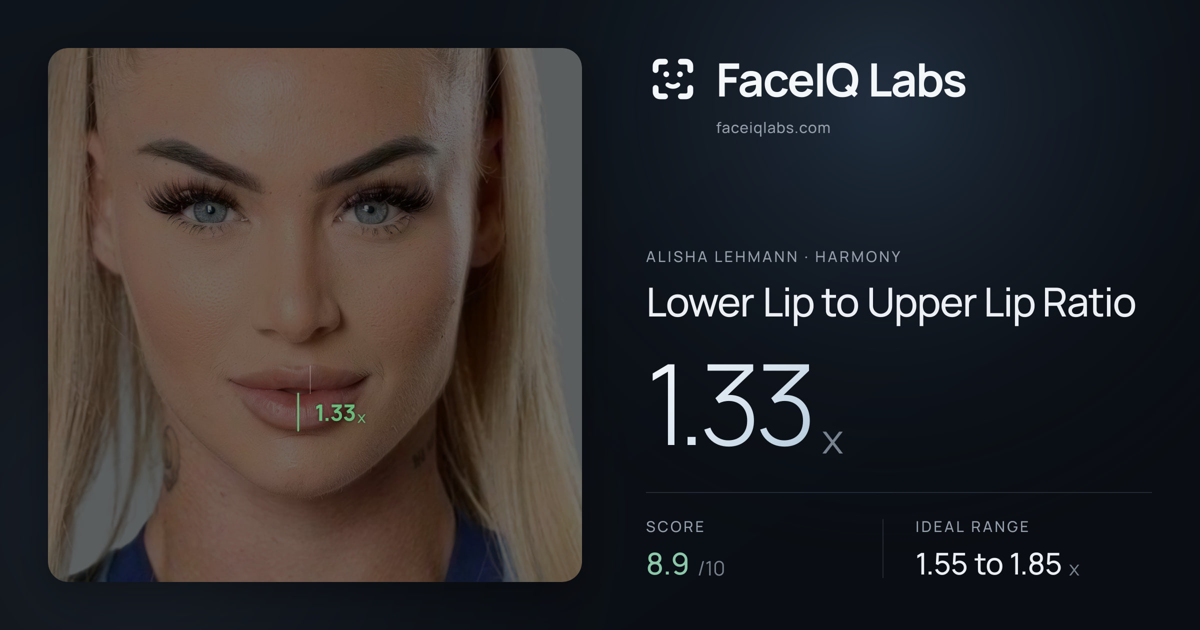 Alisha Lehmann Lower Lip to Upper Lip Ratio: 1.33x, drawn on the photo