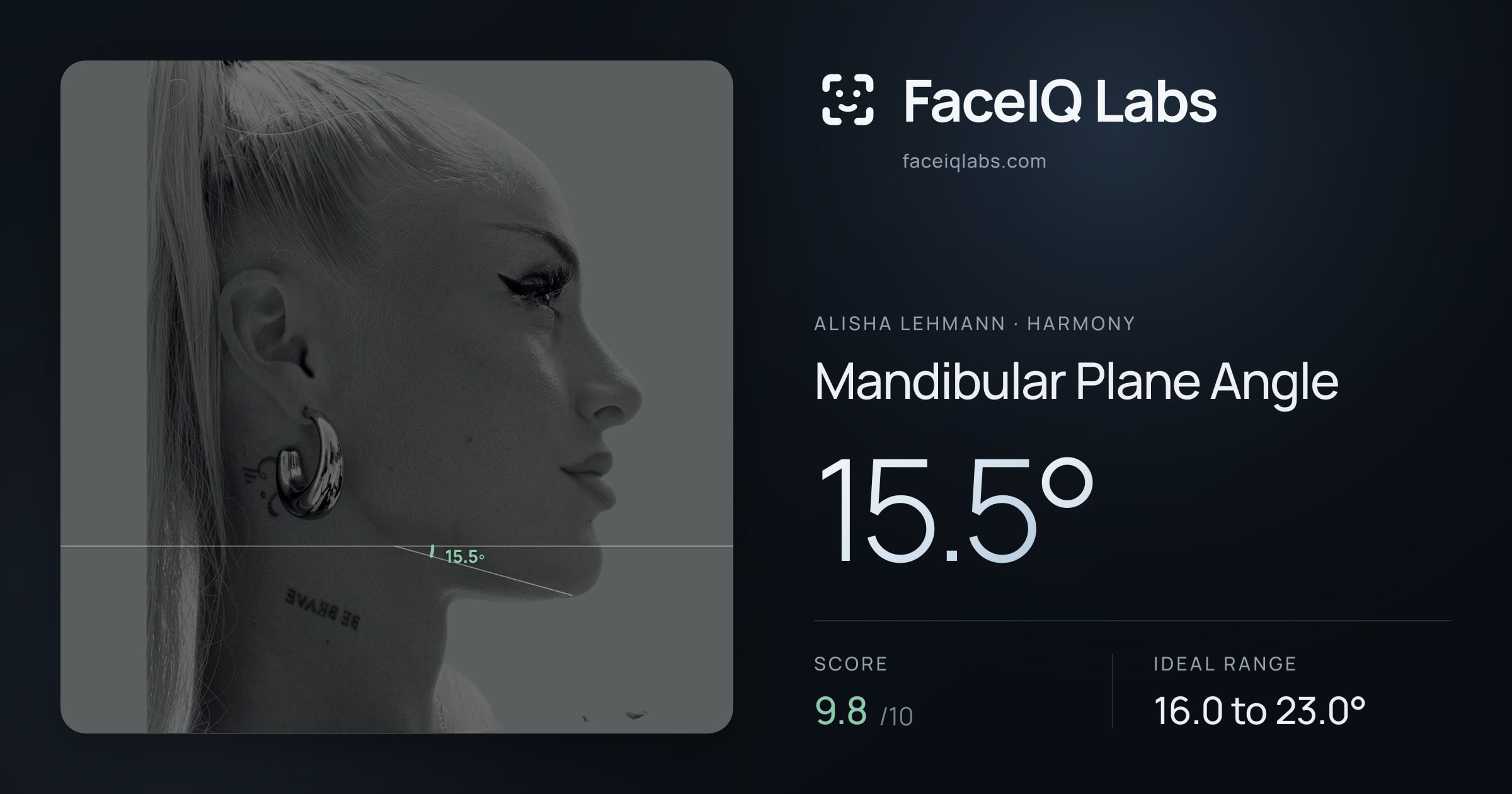 Alisha Lehmann Mandibular Plane Angle: 15.5°, drawn on the photo