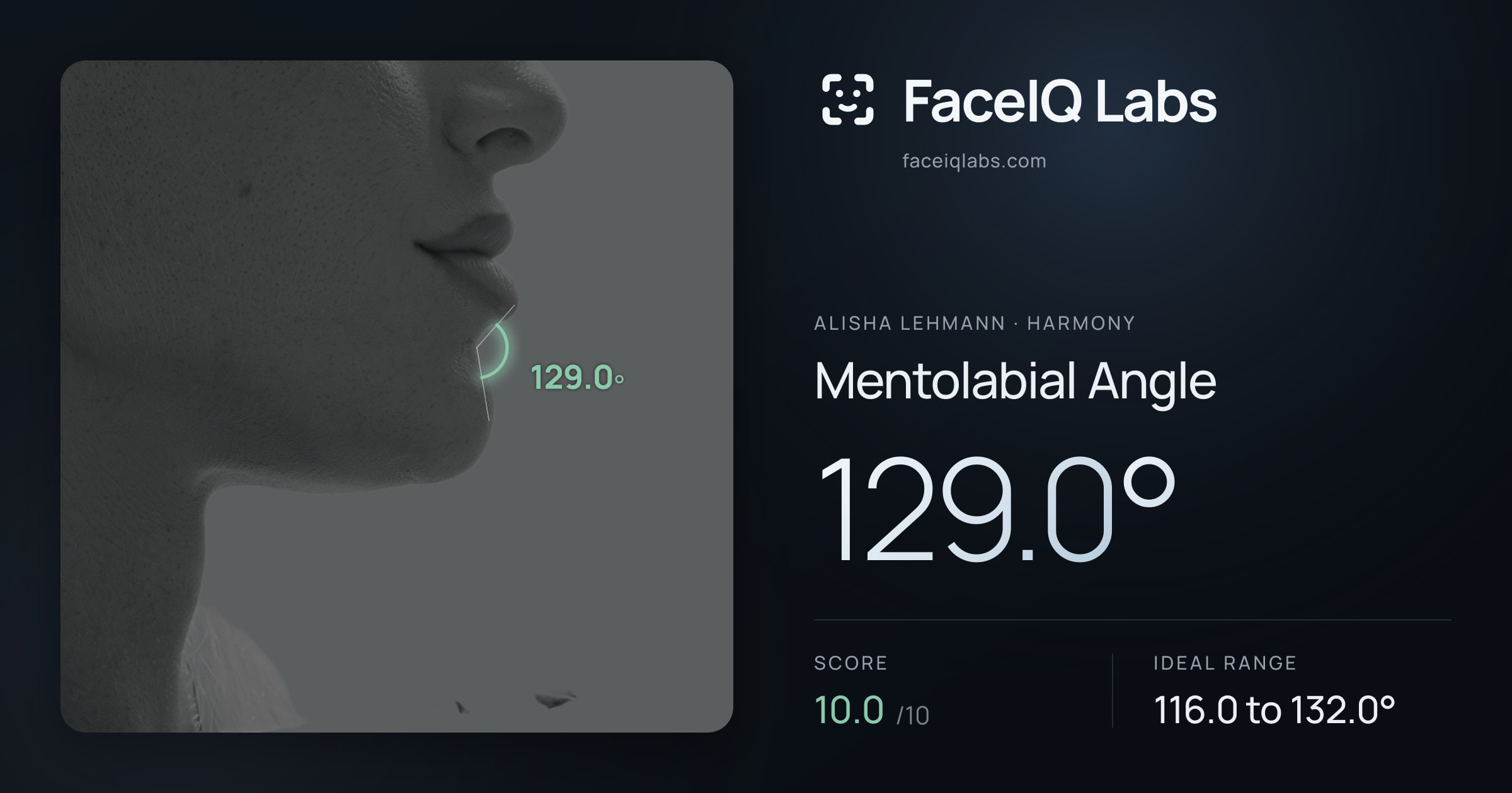 Alisha Lehmann Mentolabial Angle: 129.0°, drawn on the photo