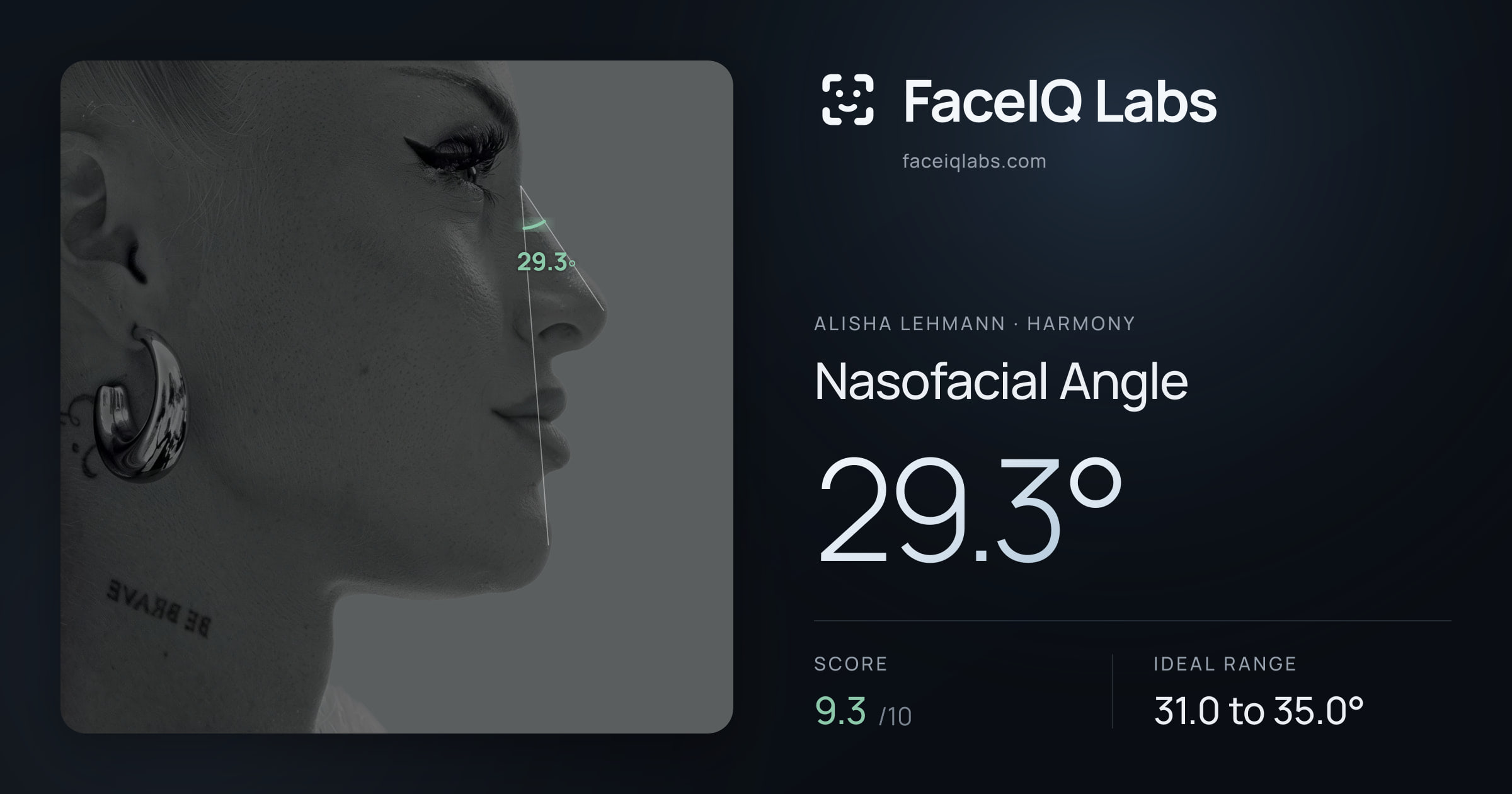 Alisha Lehmann Nasofacial Angle: 29.3°, drawn on the photo