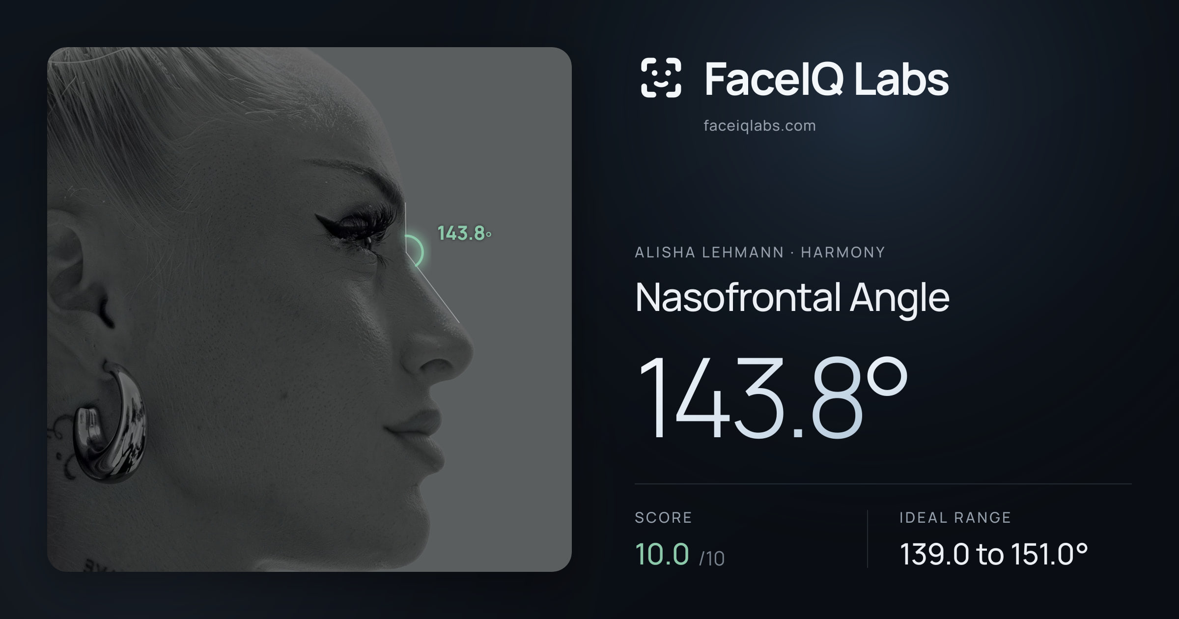 Alisha Lehmann Nasofrontal Angle: 143.8°, drawn on the photo