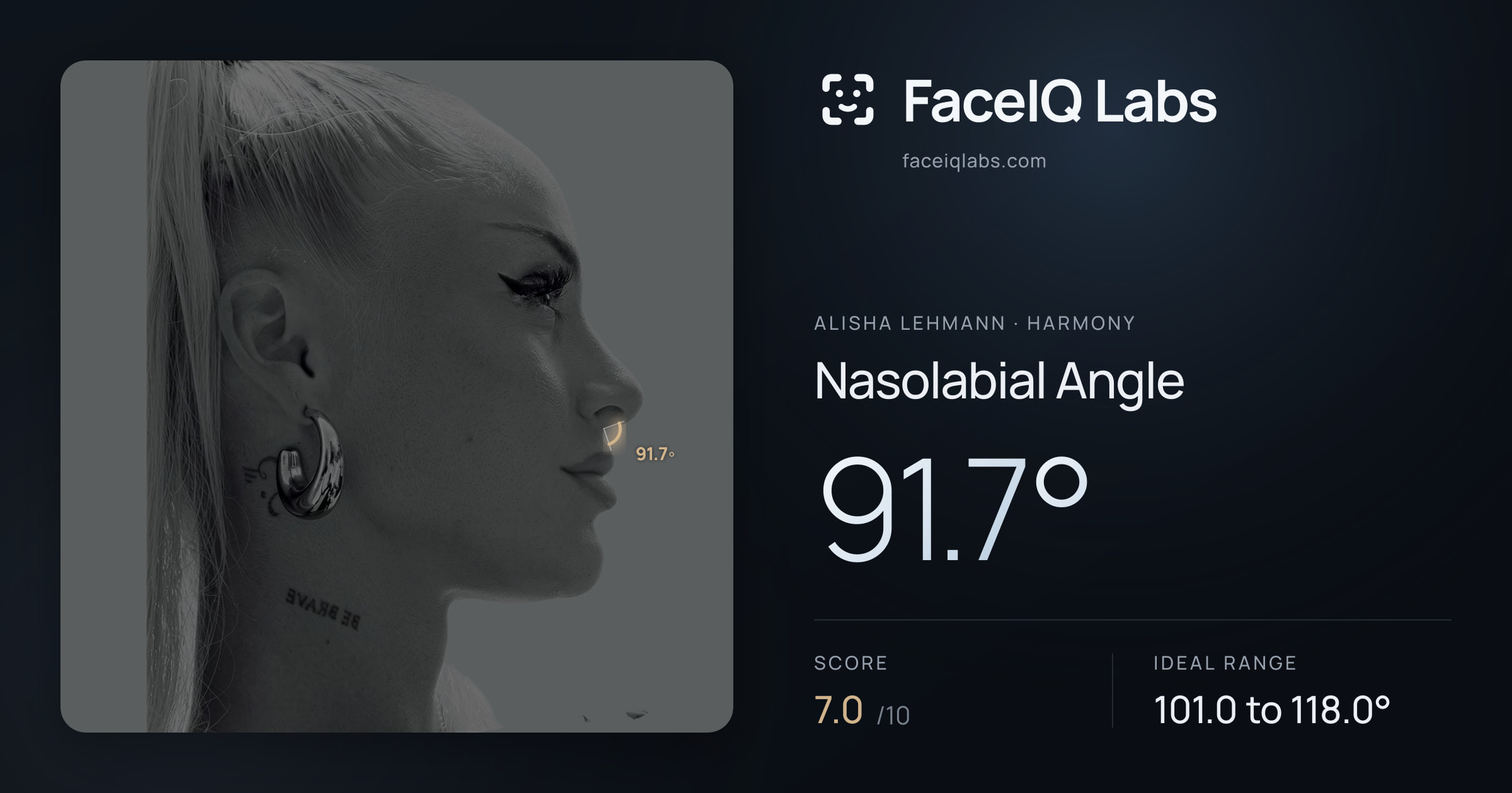 Alisha Lehmann Nasolabial Angle: 91.7°, drawn on the photo