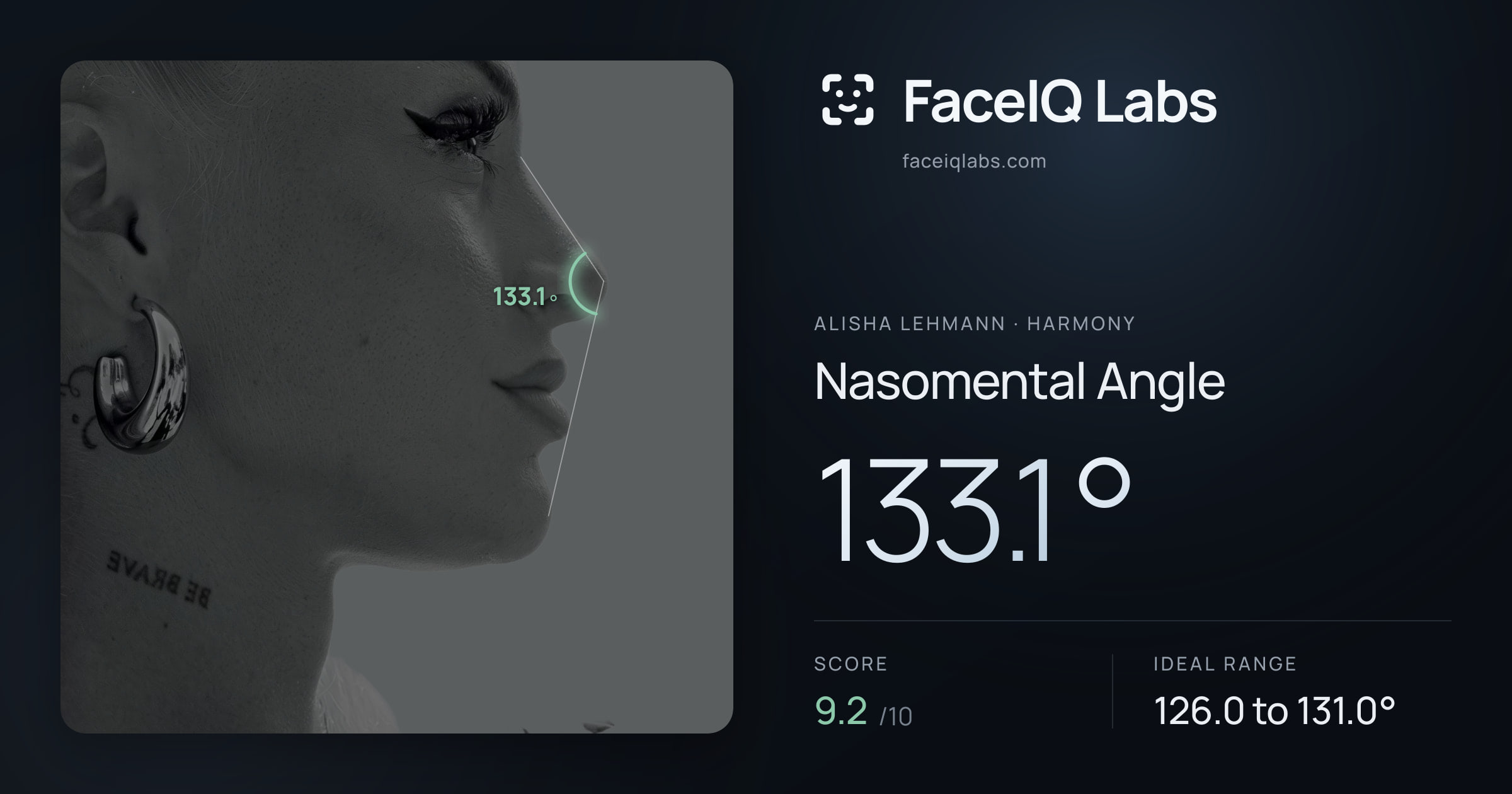 Alisha Lehmann Nasomental Angle: 133.1°, drawn on the photo