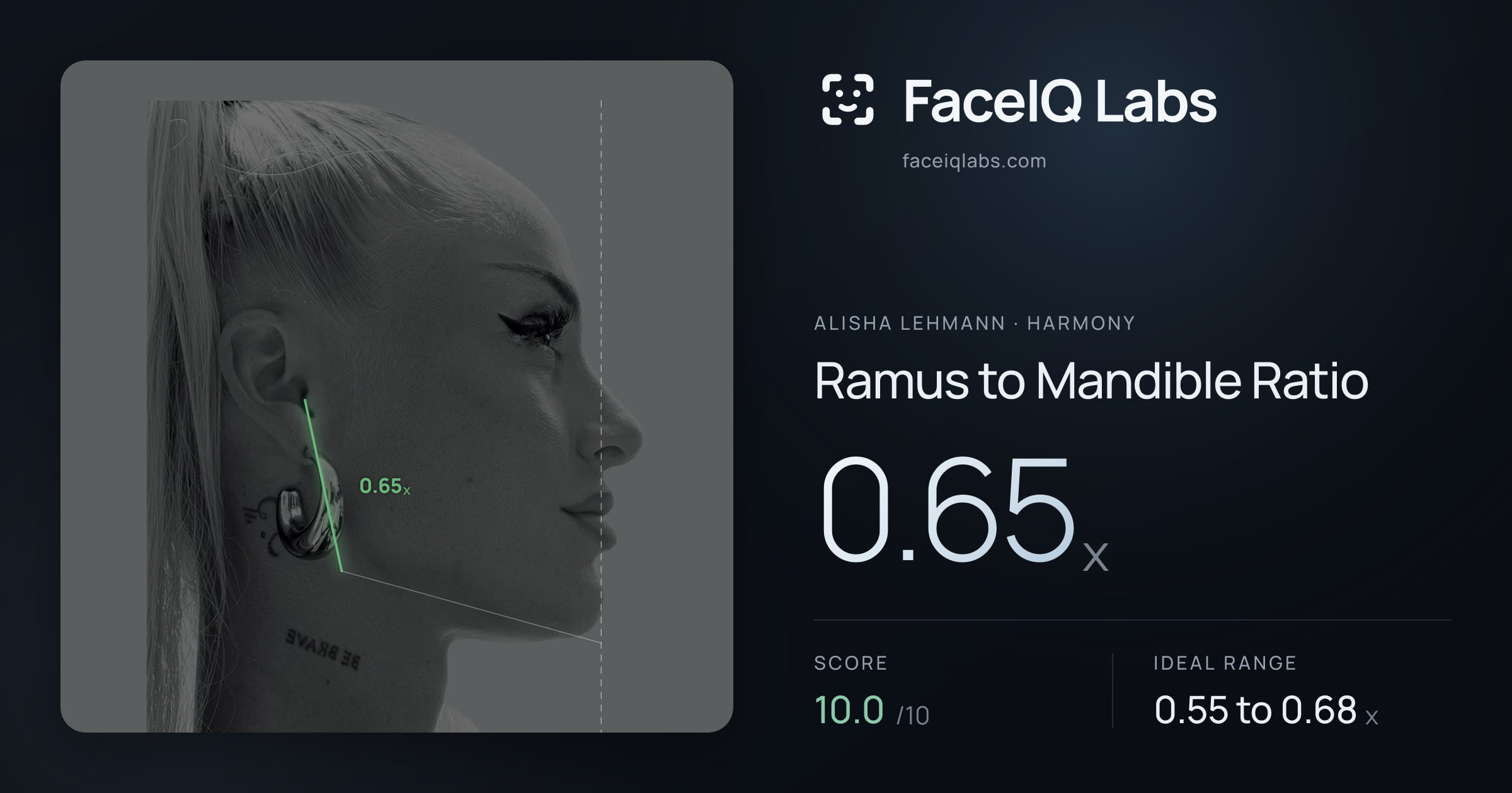 Alisha Lehmann Ramus to Mandible Ratio: 0.65x, drawn on the photo