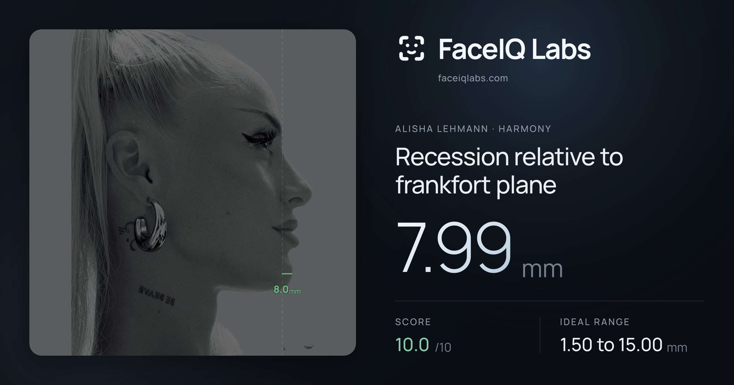 Alisha Lehmann Recession relative to frankfort plane: 7.99mm, drawn on the photo