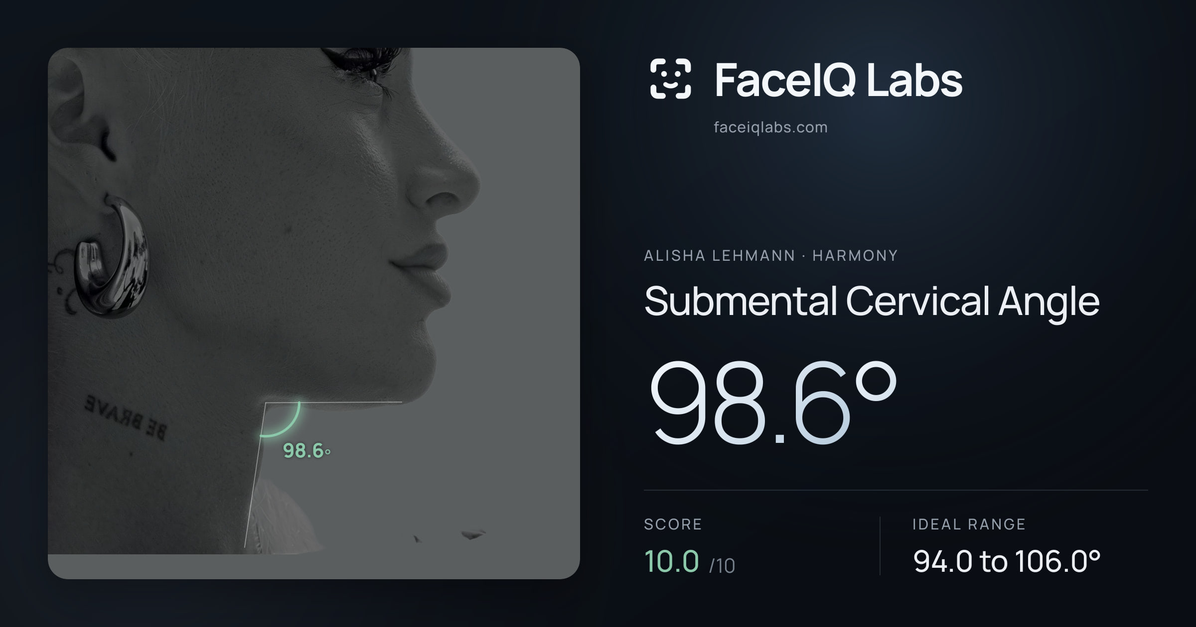 Alisha Lehmann Submental Cervical Angle: 98.6°, drawn on the photo