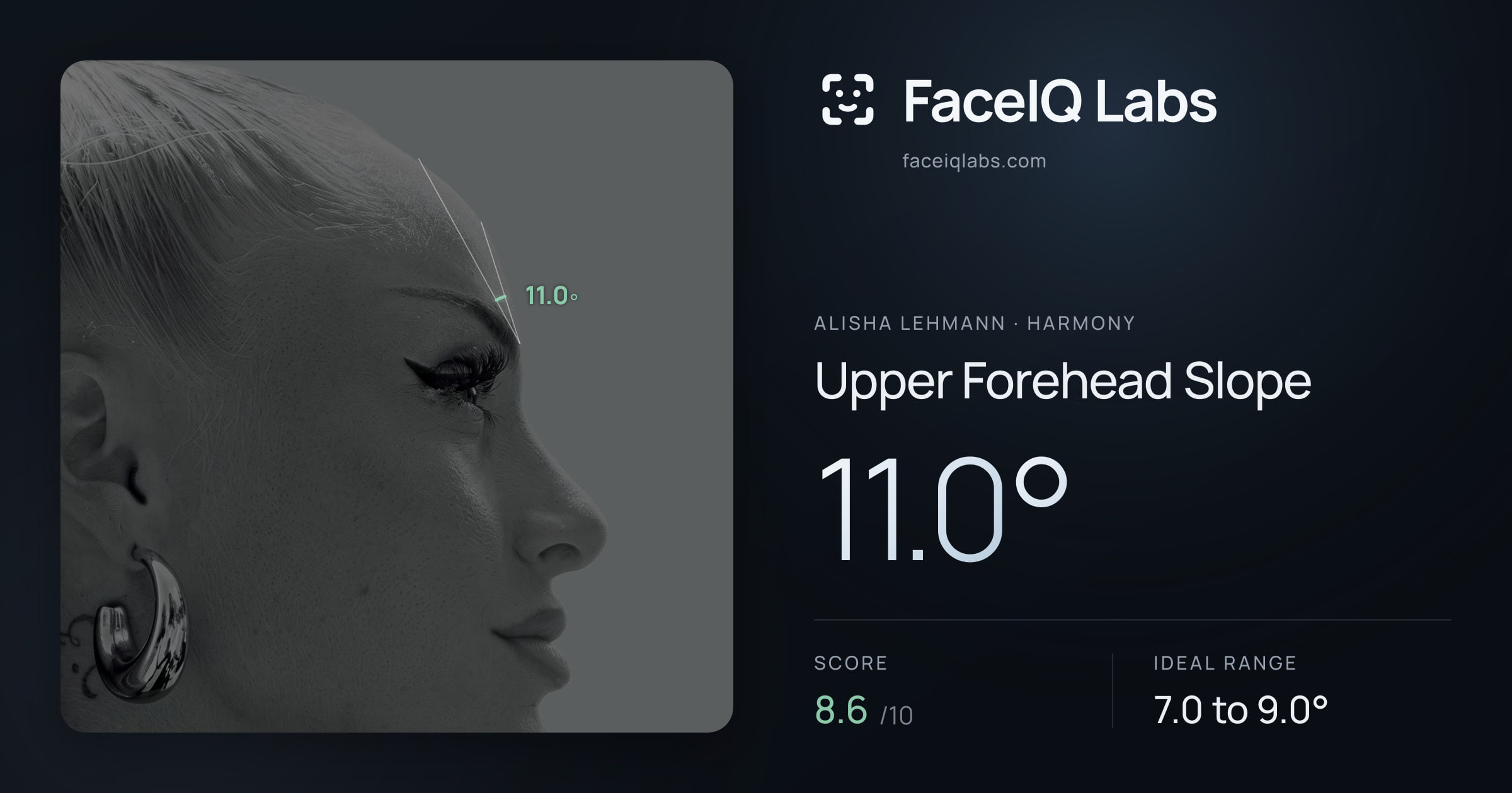 Alisha Lehmann Upper Forehead Slope: 11.0°, drawn on the photo