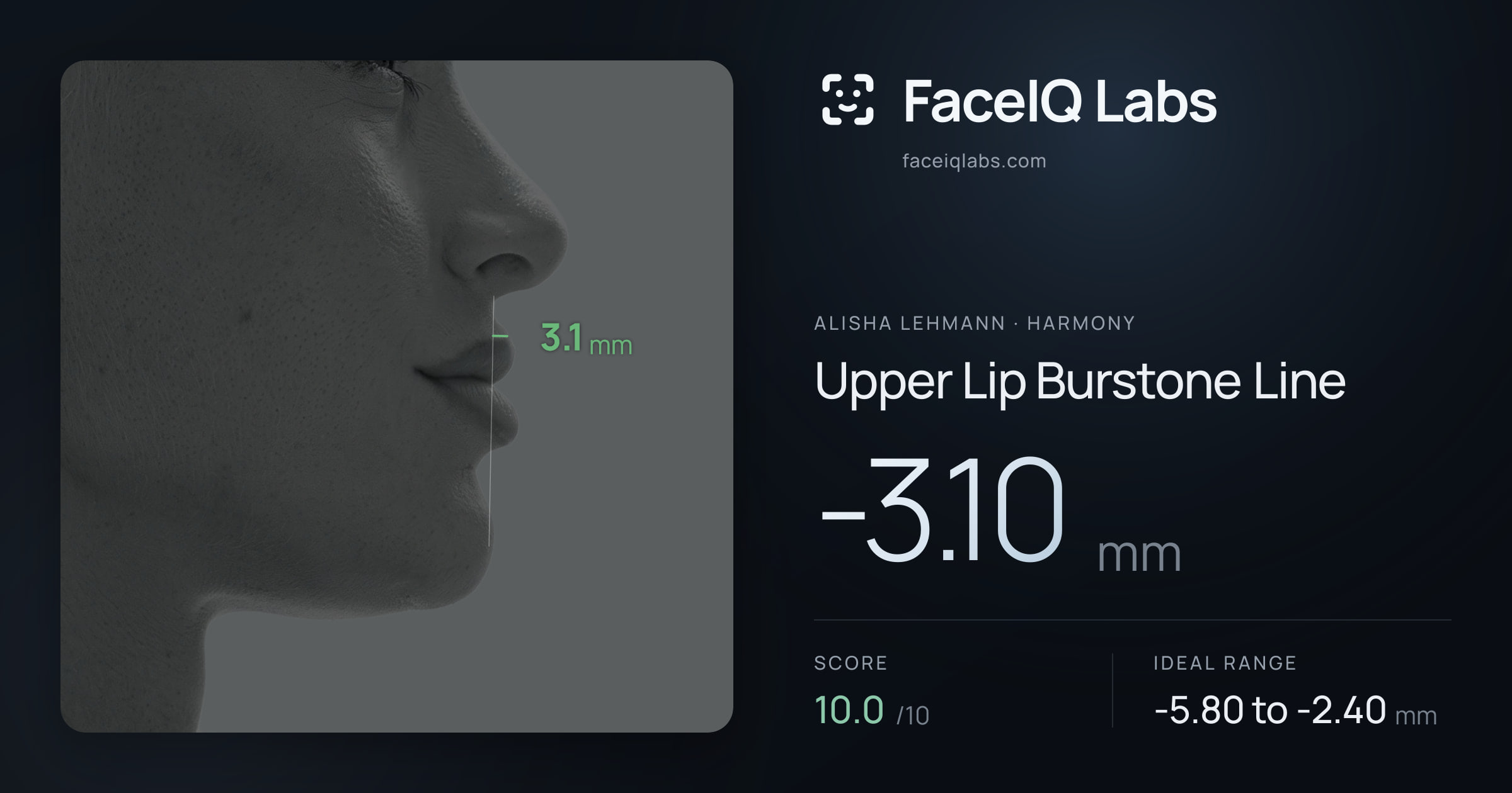 Alisha Lehmann Upper Lip Burstone Line: -3.10mm, drawn on the photo