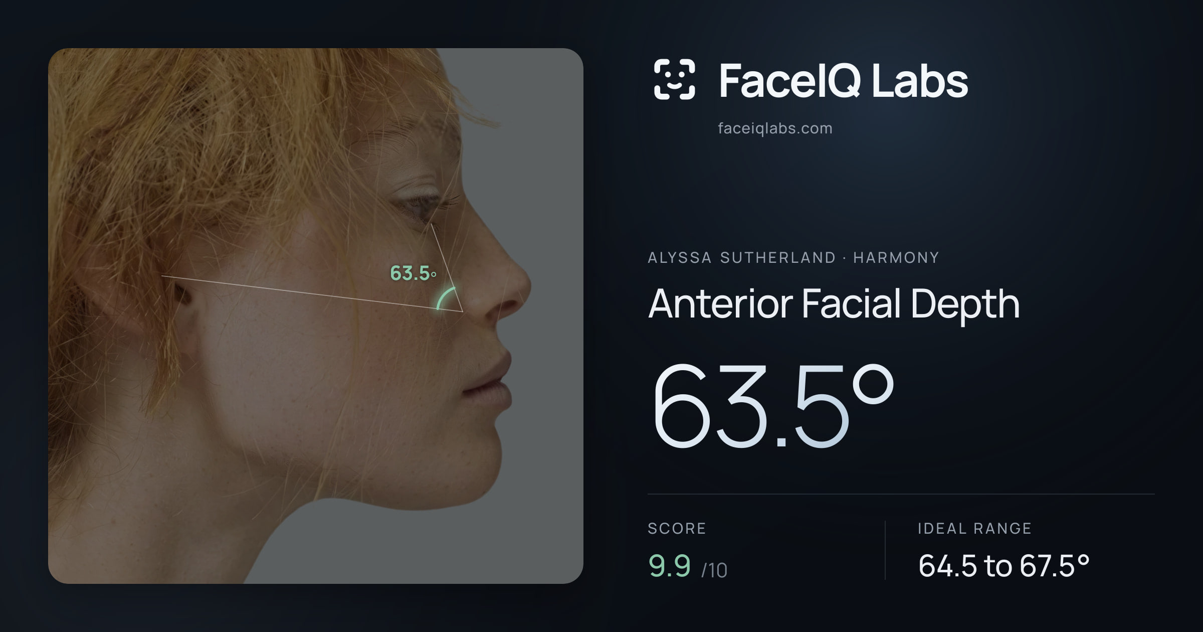 Alyssa Sutherland Anterior Facial Depth: 63.5°, drawn on the photo