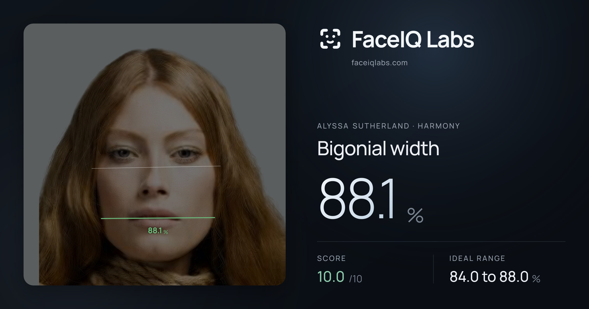 Alyssa Sutherland Bigonial width: 88.1%, drawn on the photo