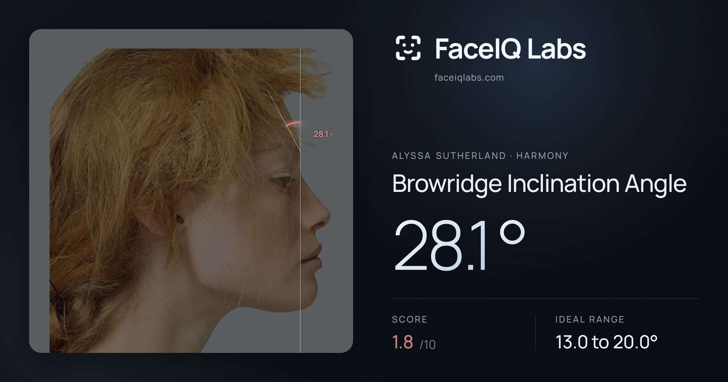 Alyssa Sutherland Browridge Inclination Angle: 28.1°, drawn on the photo