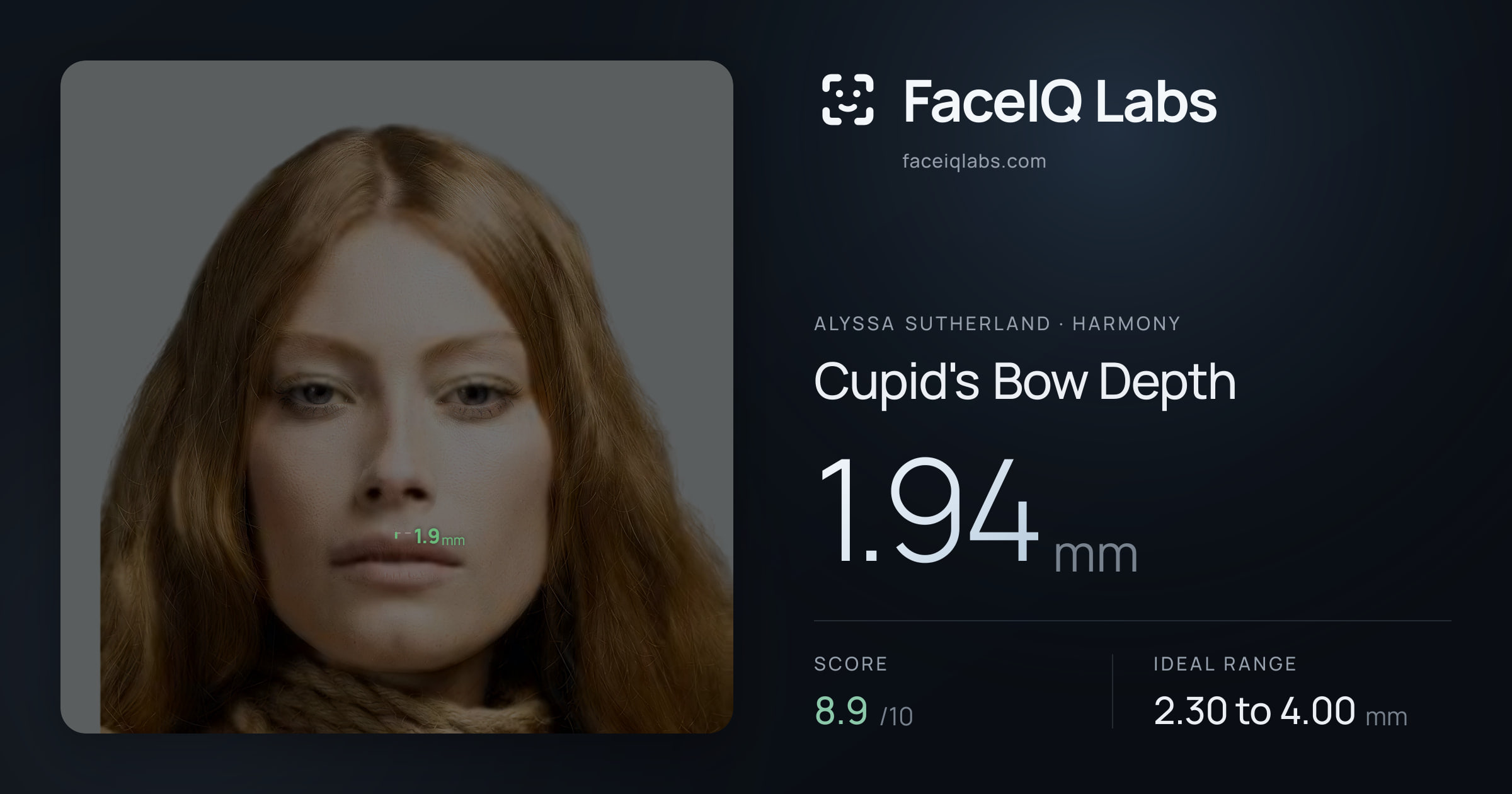 Alyssa Sutherland Cupid's Bow Depth: 1.94mm, drawn on the photo